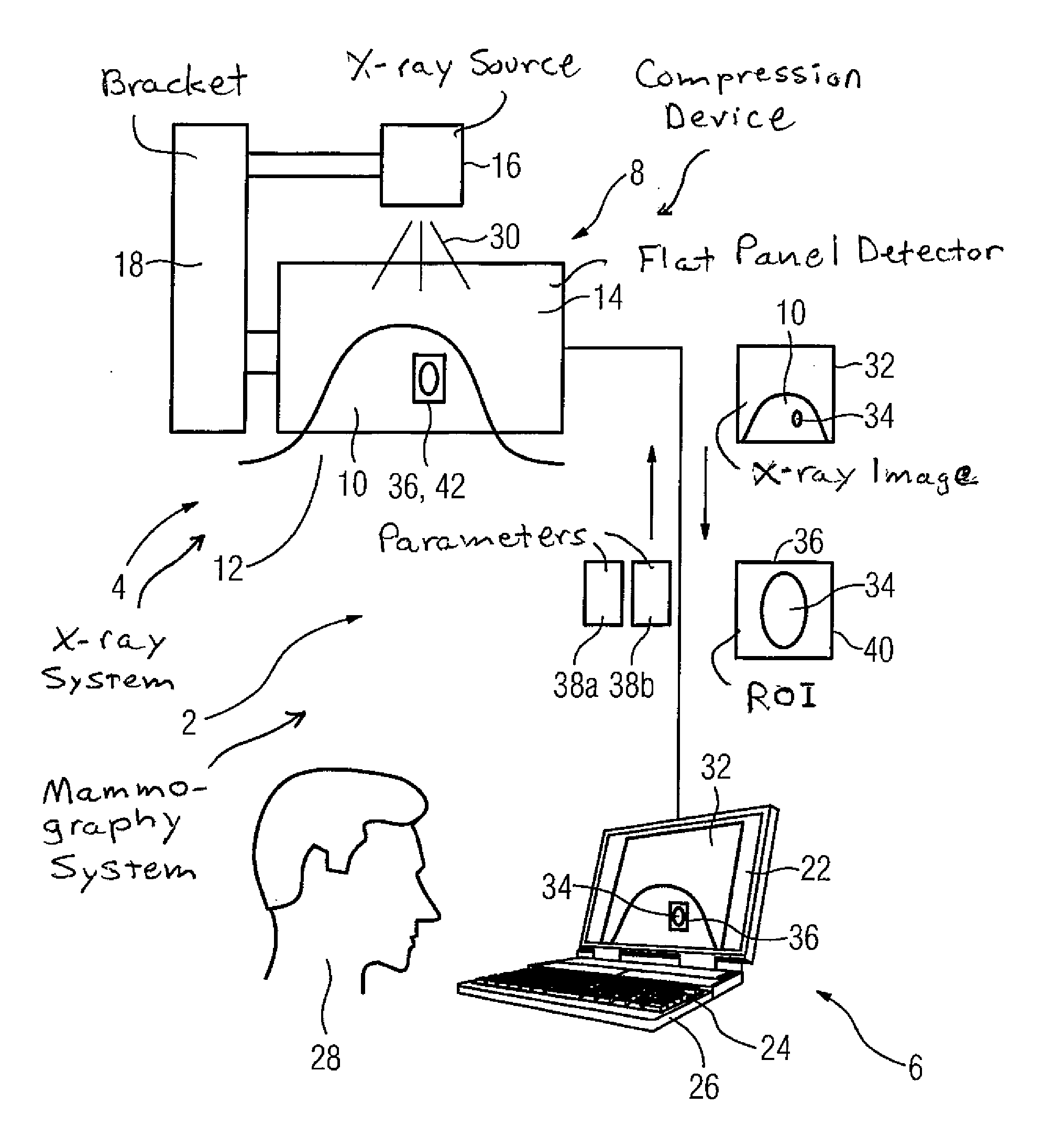 Method for producing an x-ray image during a mammography
