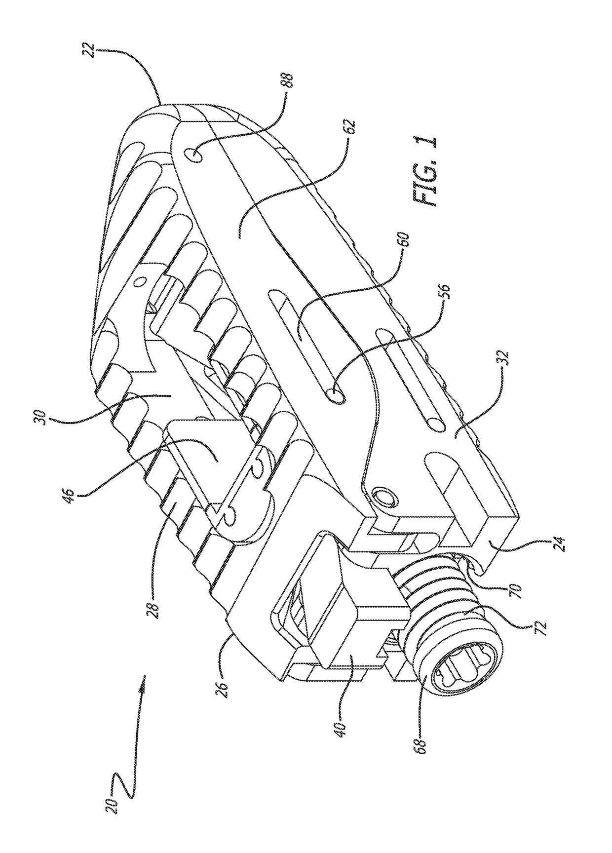 Expandable interbody implant