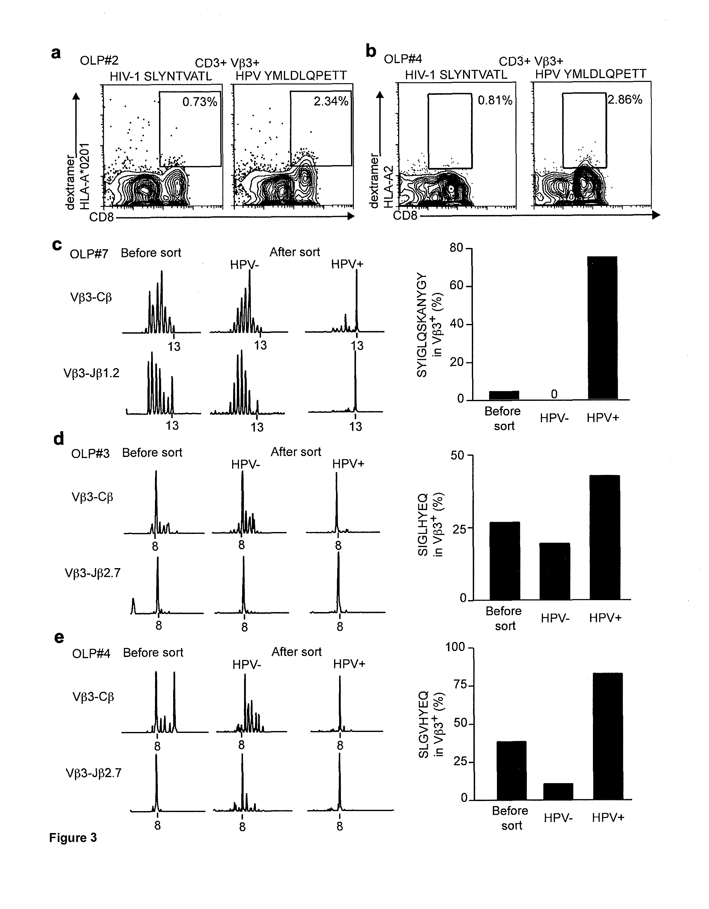 Correlation of disease activity with clonal expansions of human papillomavirus 16-specific cd8+ t-cells in patients with severe erosive oral lichen planus