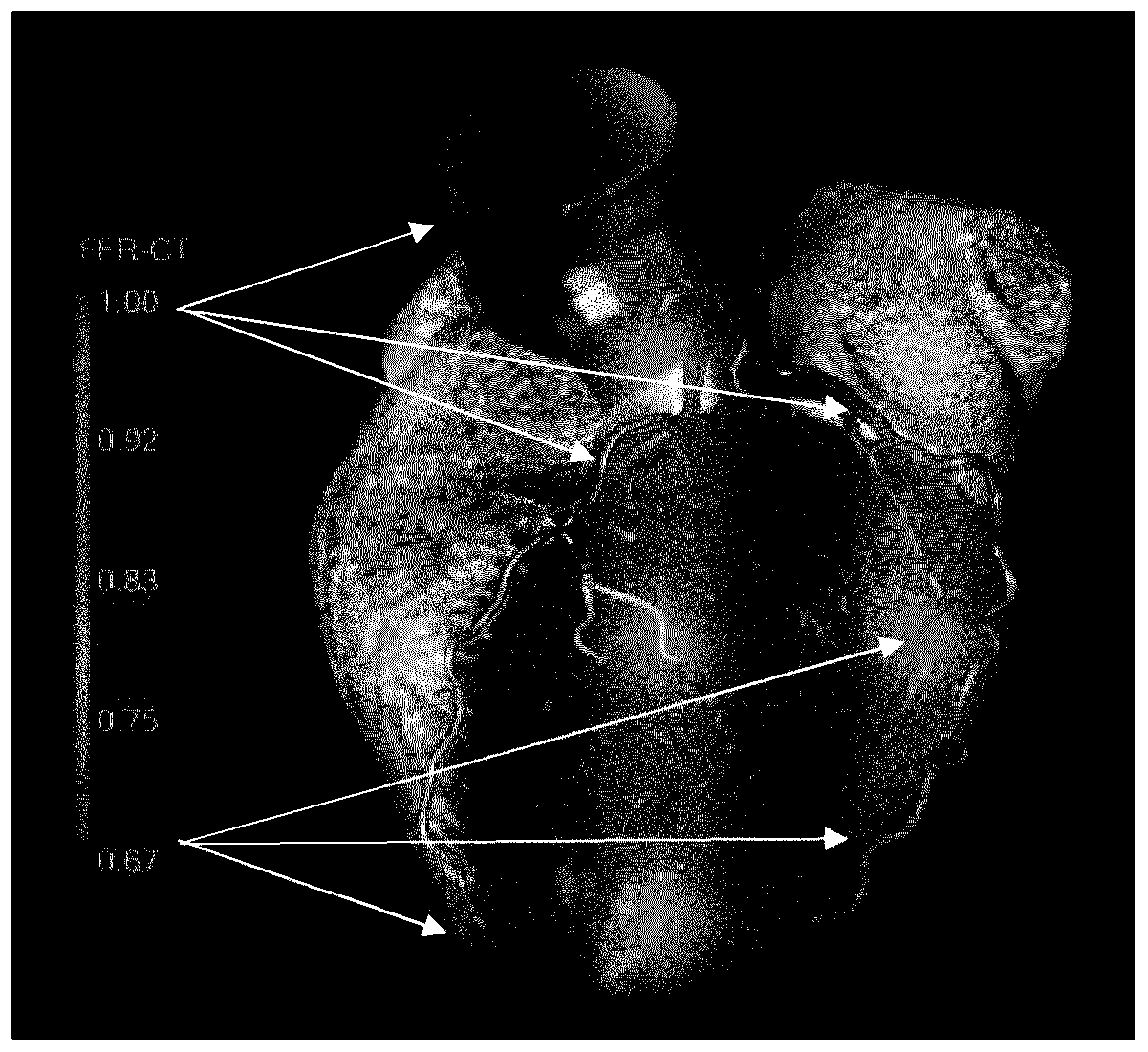 Myocardial CT perfusion image synthesis