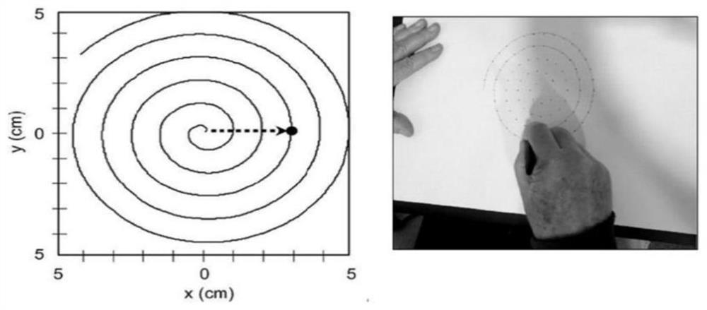 Intelligent decision support method and system based on electronic hand-drawn spiral test