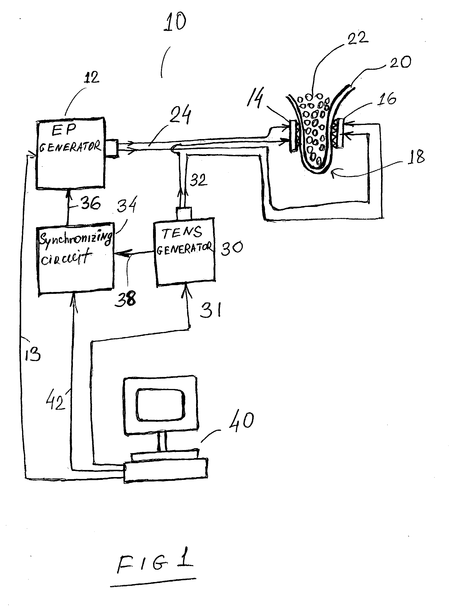 Apparatus and method for reducing subcutaneous fat deposits by electroporation with improved comfort of patients