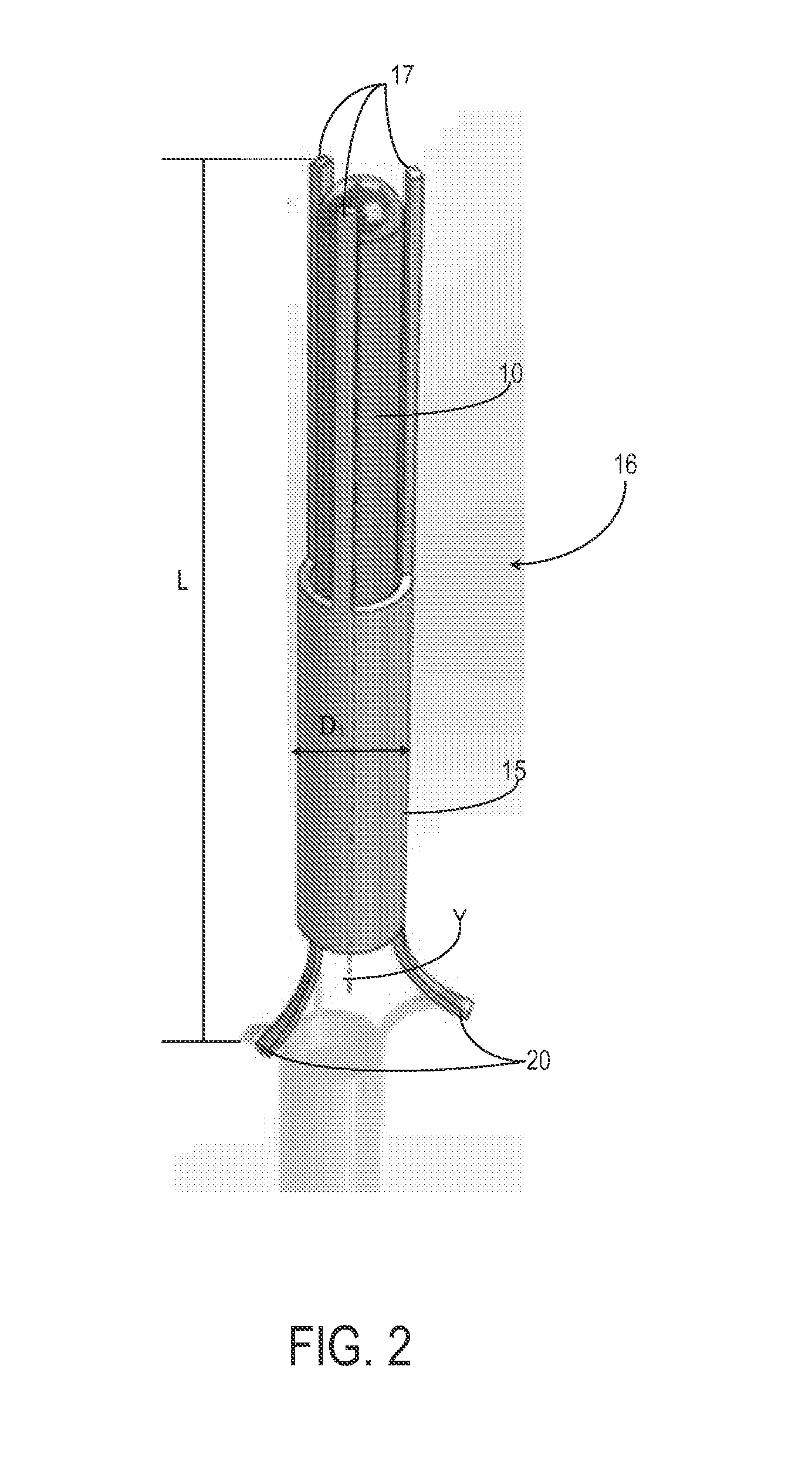 System and method for a tissue resection margin measurement device