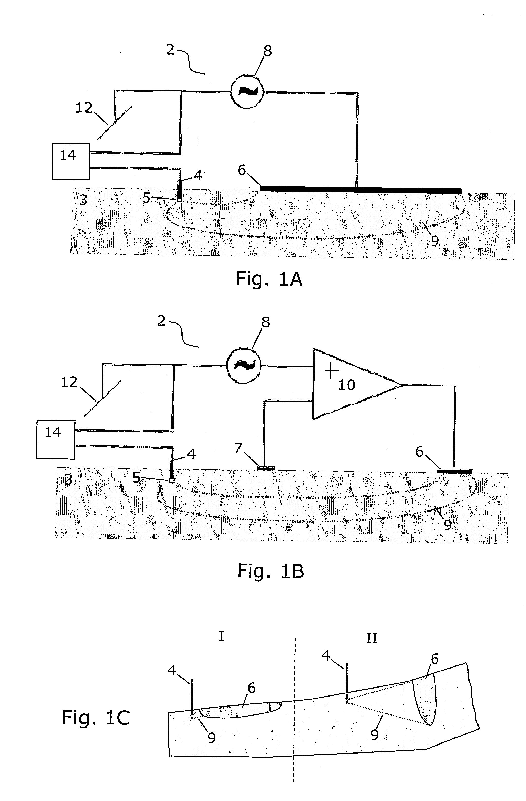 Method and apparatus for determining local tissue impedance for positioning of a needle