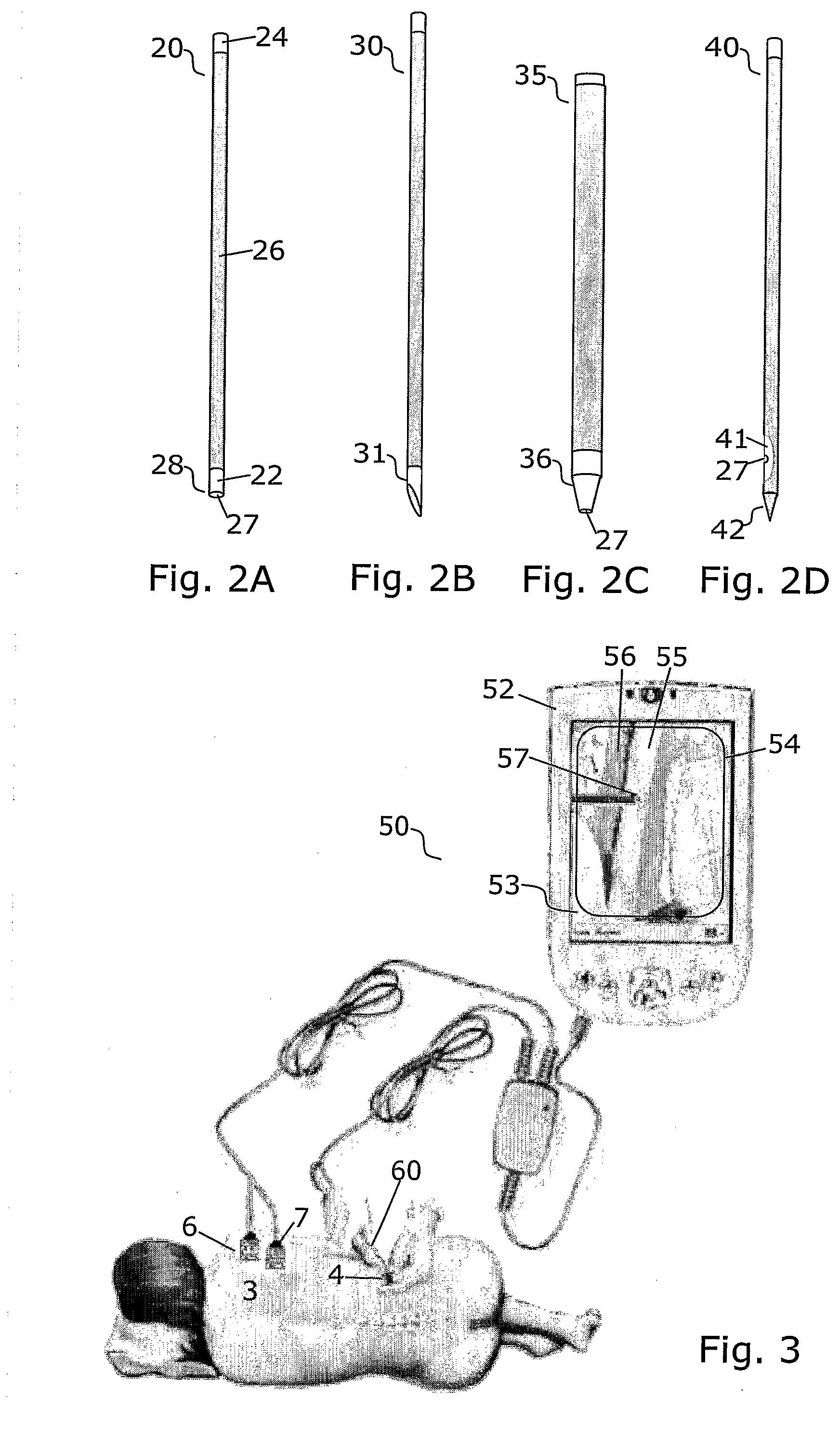 Method and apparatus for determining local tissue impedance for positioning of a needle