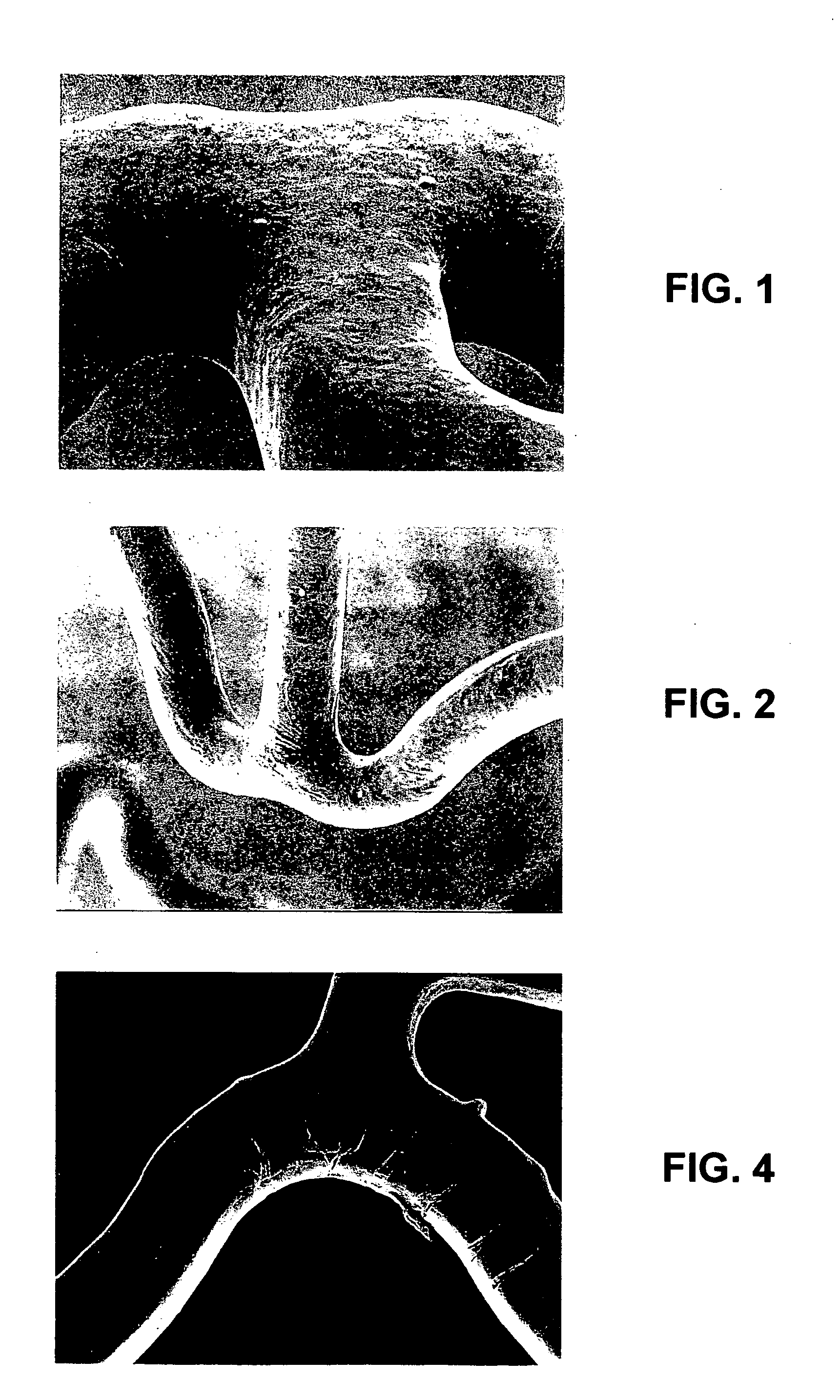 Coatings for implantable devices including biologically erodable polyesters and methods for fabricating the same