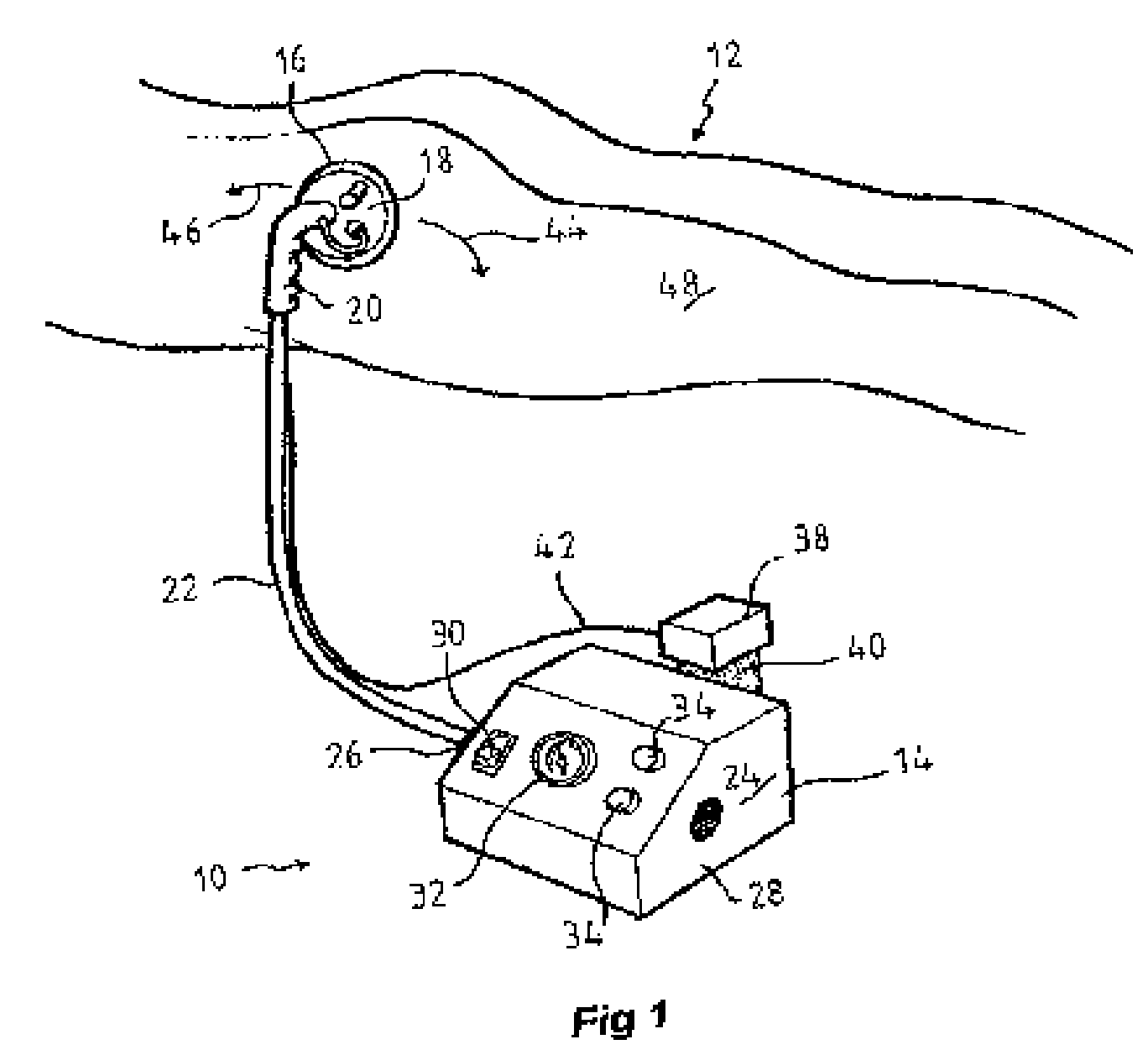 Aparatus and method of body contouring and skin conditioning using a mobile suction device