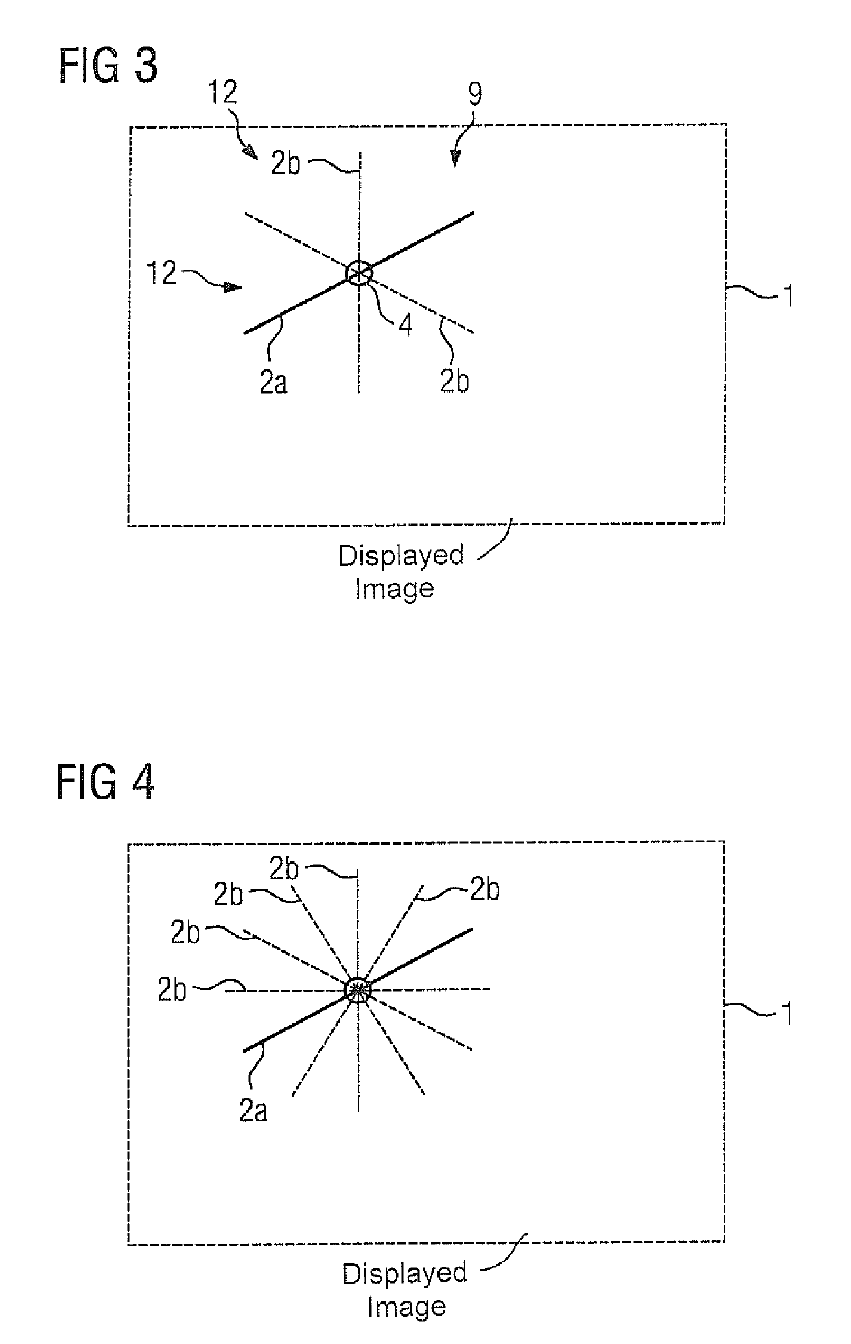 Method and magnetic resonance apparatus for setting acquisition parameters of a scan protocol