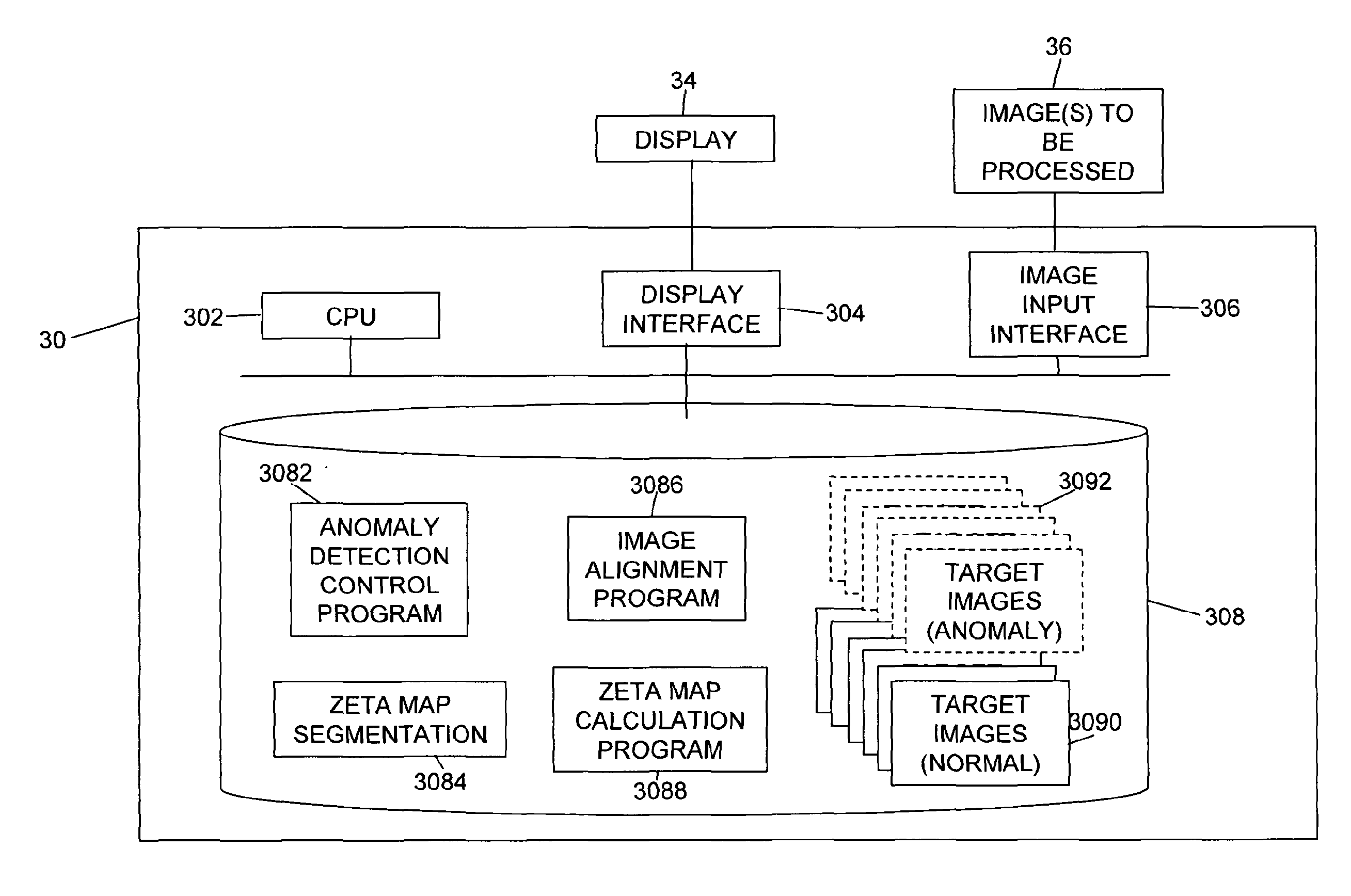 Method and system for anomaly detection in data sets