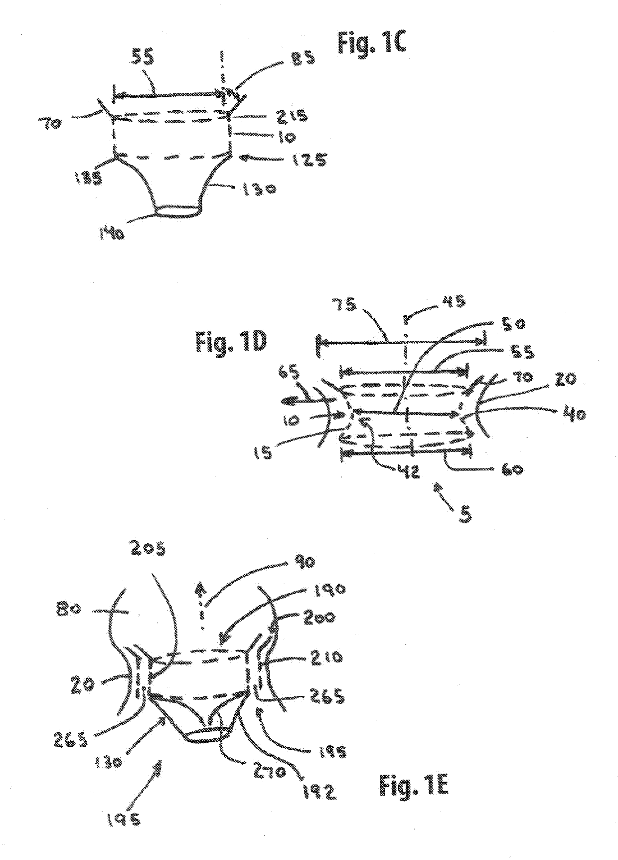 Annuloplasty Device and Methods