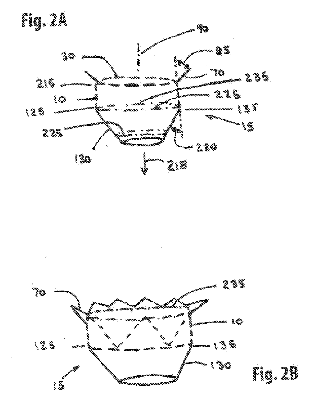 Annuloplasty Device and Methods