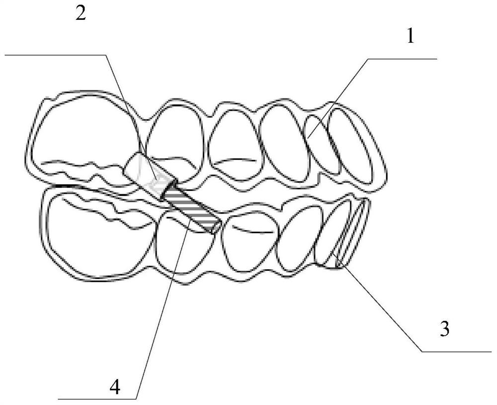 Rod sleeve type lower jaw protraction device