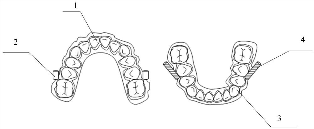 Rod sleeve type lower jaw protraction device