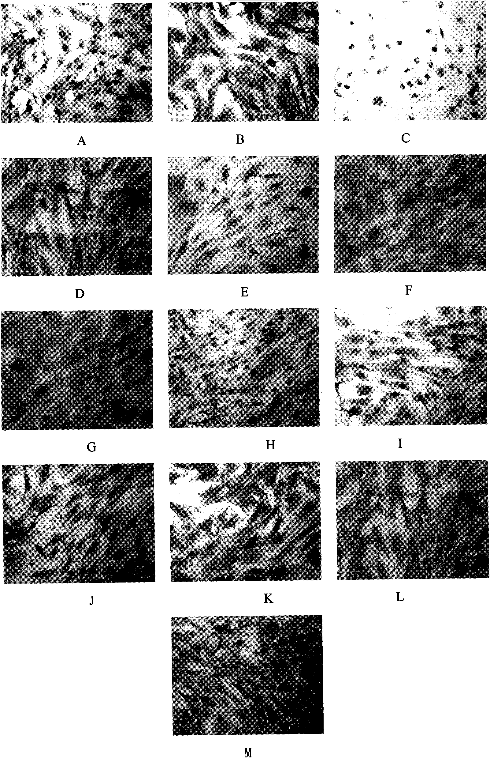 Pharmaceutical composition for treating diabetic nephropathy and preparation method and application thereof
