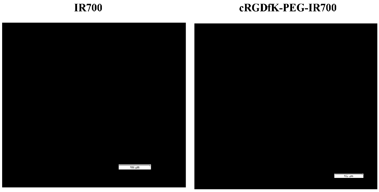 Nanometer drug delivering system capable of realizing high tumor permeability and preparation method