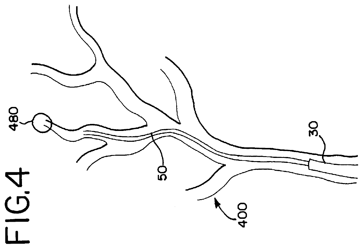 Flow directed catheter having radiopaque strain relief segment
