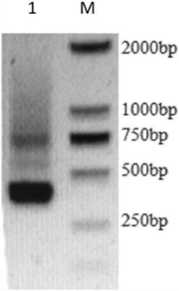 CEA (carcinoembryonic antigen) resistant nanomater antibody with high appetency and application