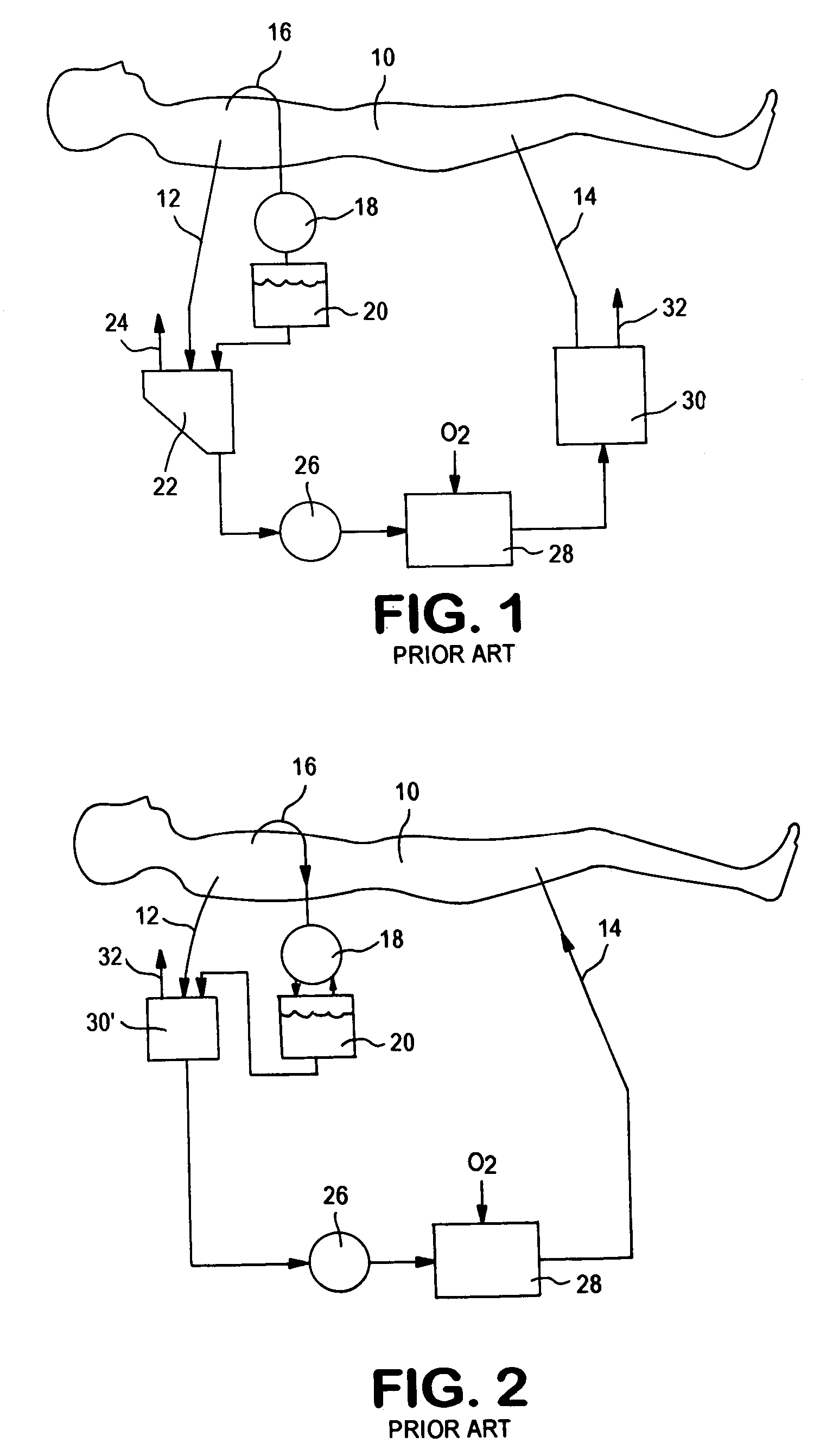 Extracorporeal blood circuit air removal system and method