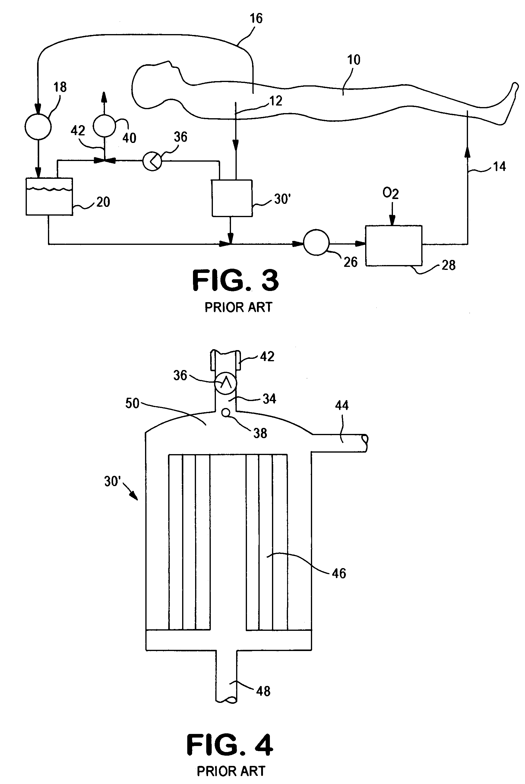 Extracorporeal blood circuit air removal system and method