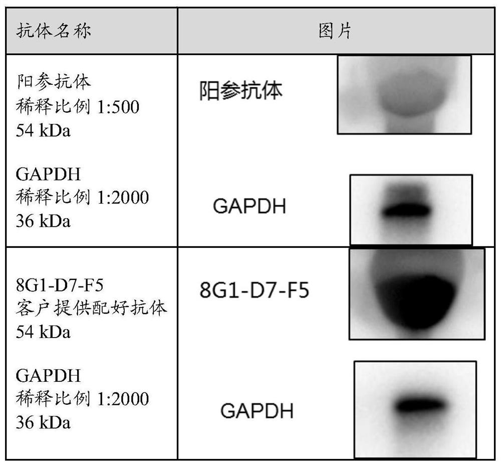 cBIN1 antibody and application thereof