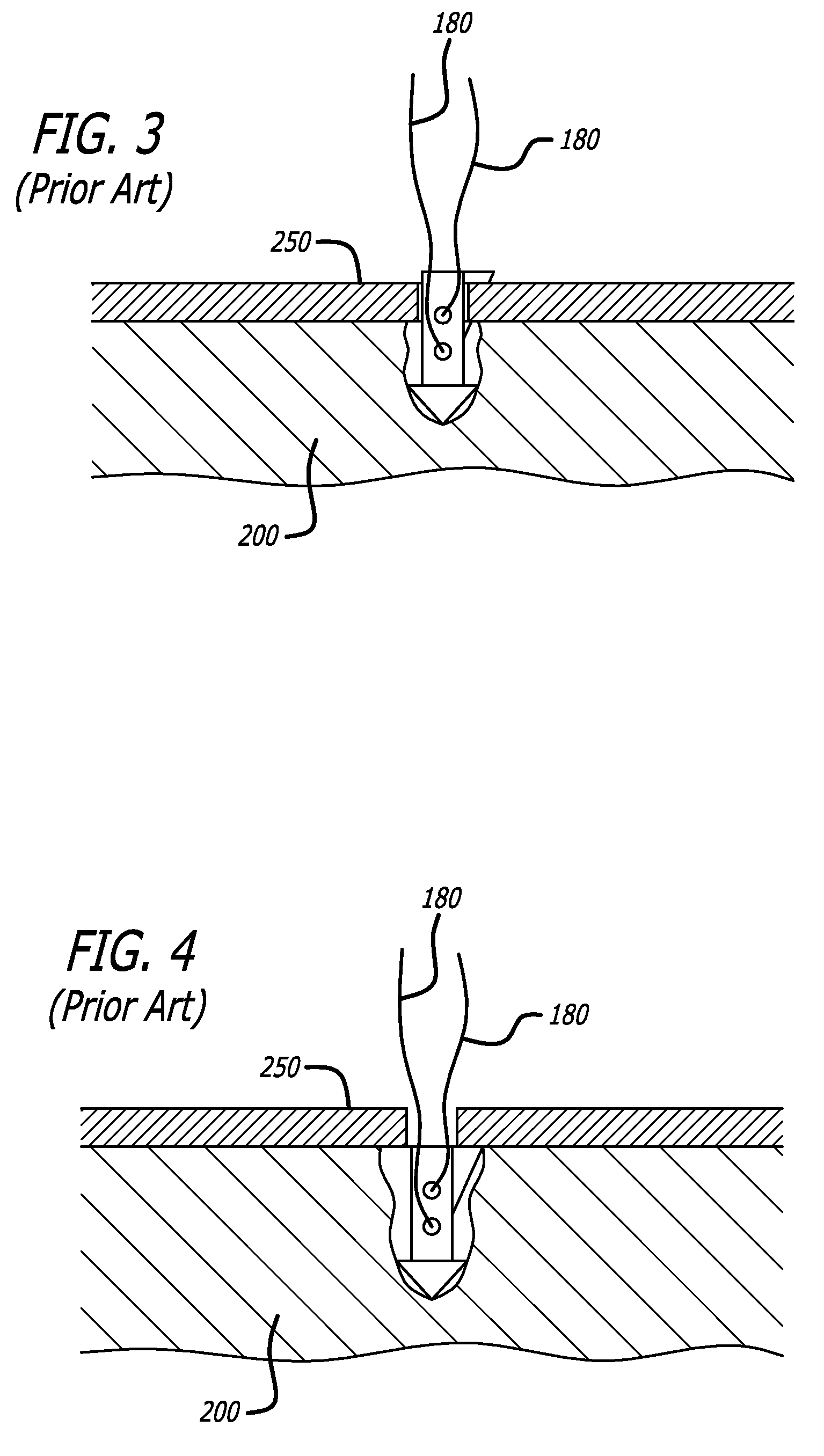 Suture anchoring devices and methods for use