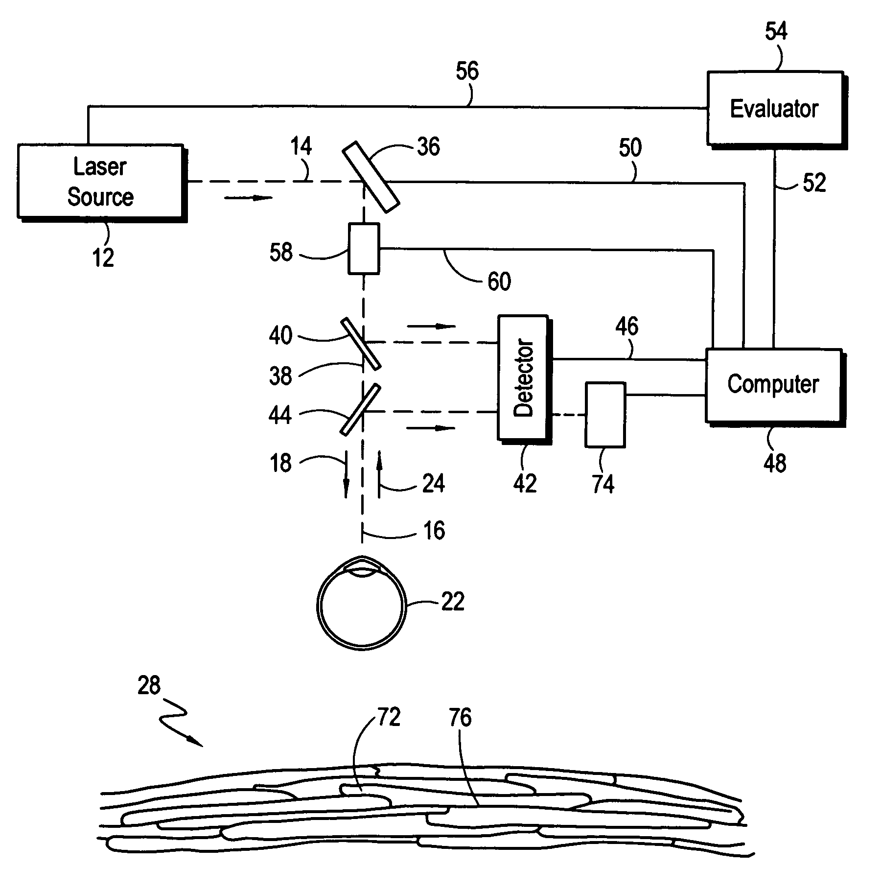 Method and apparatus for intrastromal refractive surgery