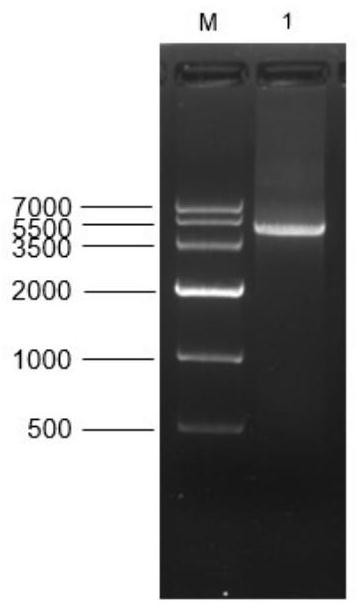 Antigen peptide of DNA methyltransferase 1 and polyclonal antibody thereof