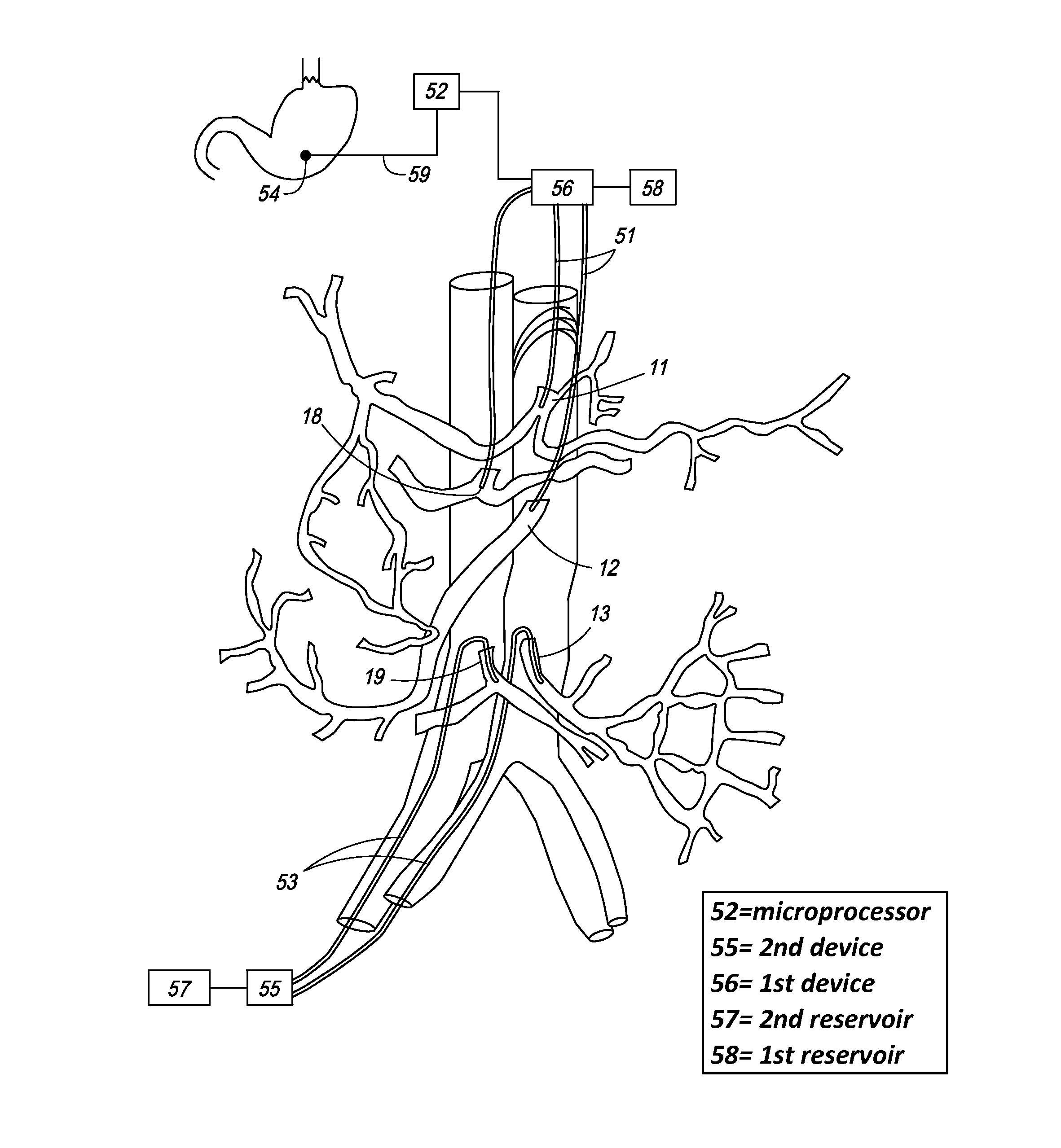 Method and apparatus for stimulating the vascular system