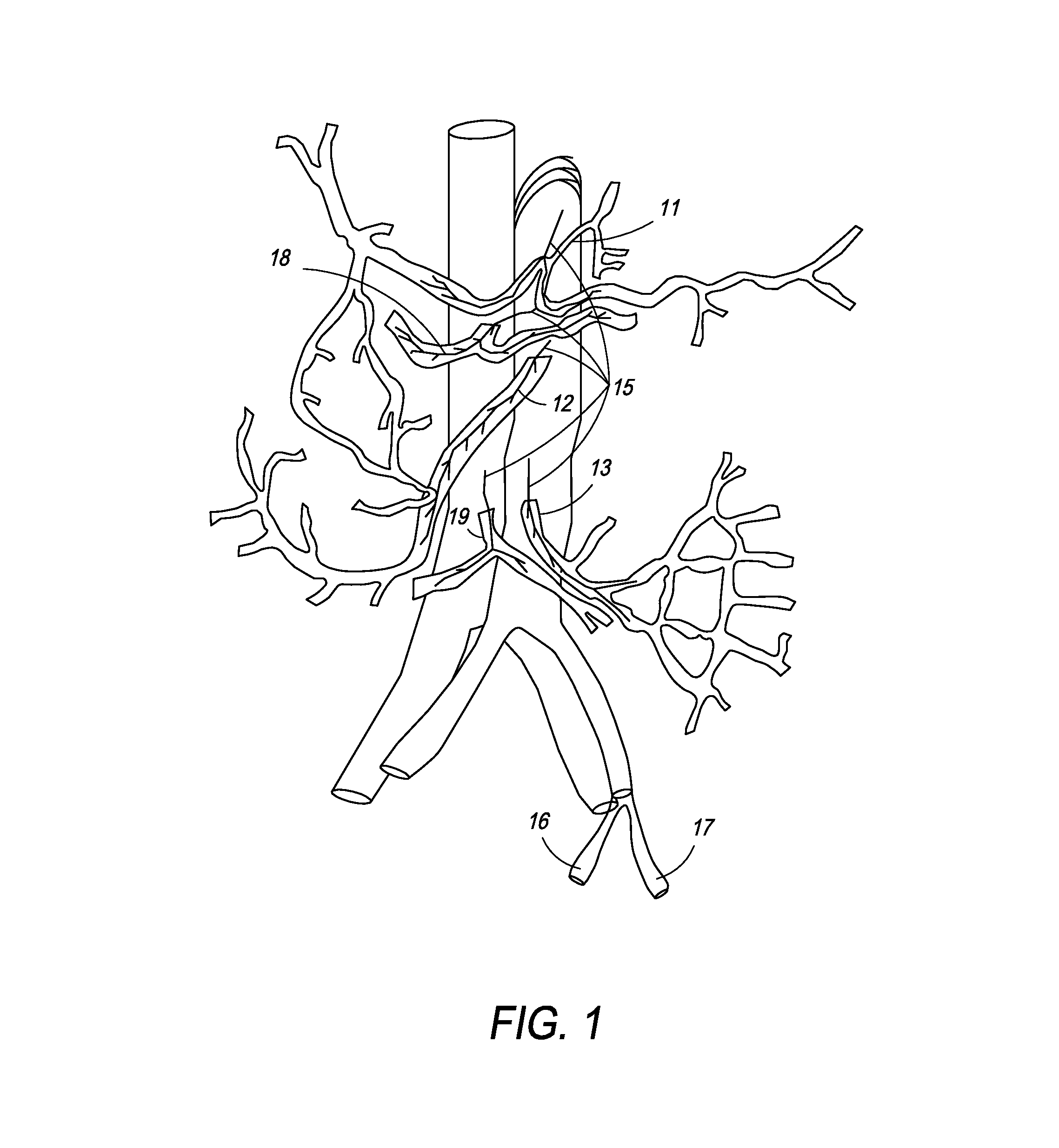 Method and apparatus for stimulating the vascular system