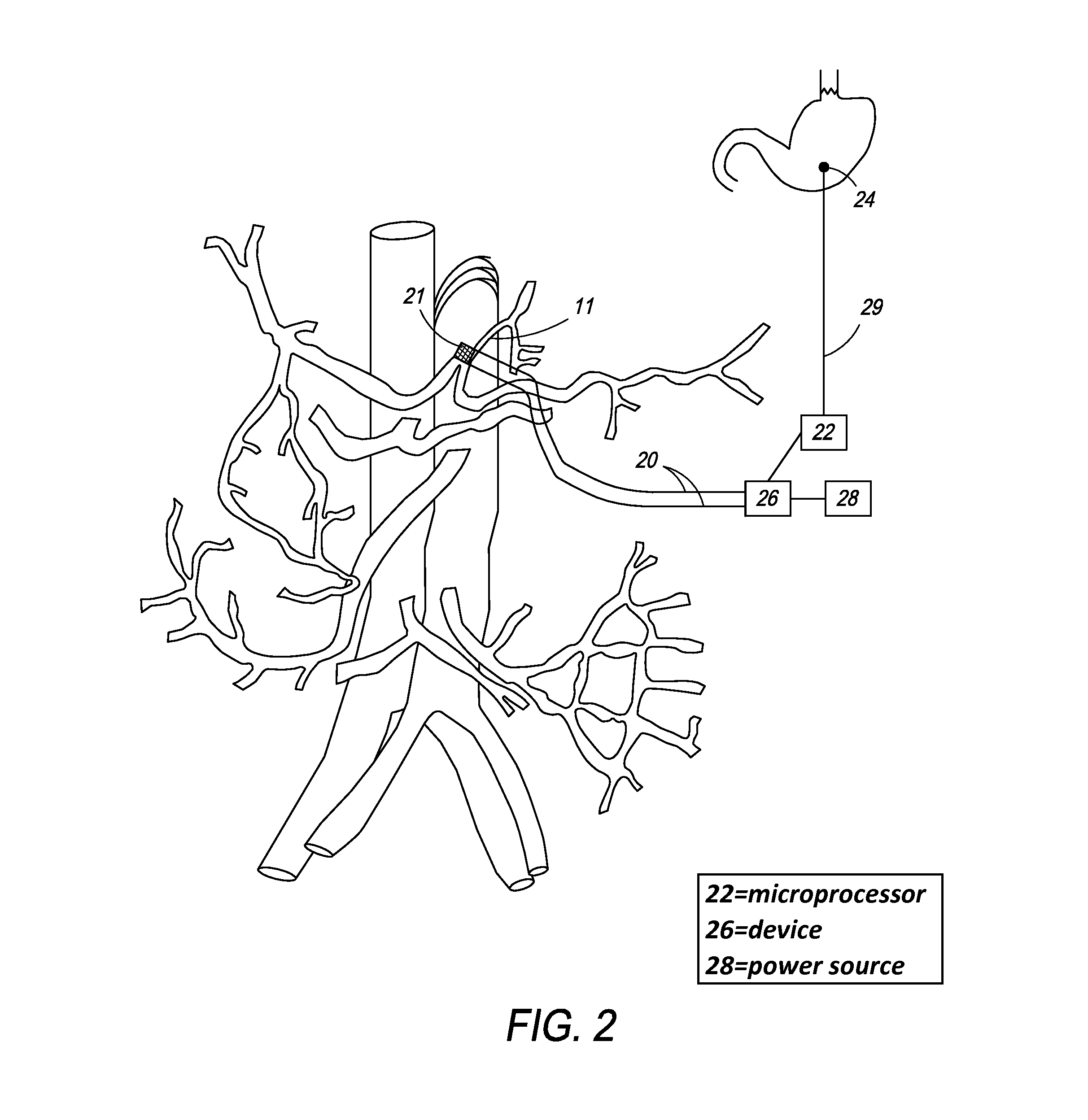 Method and apparatus for stimulating the vascular system