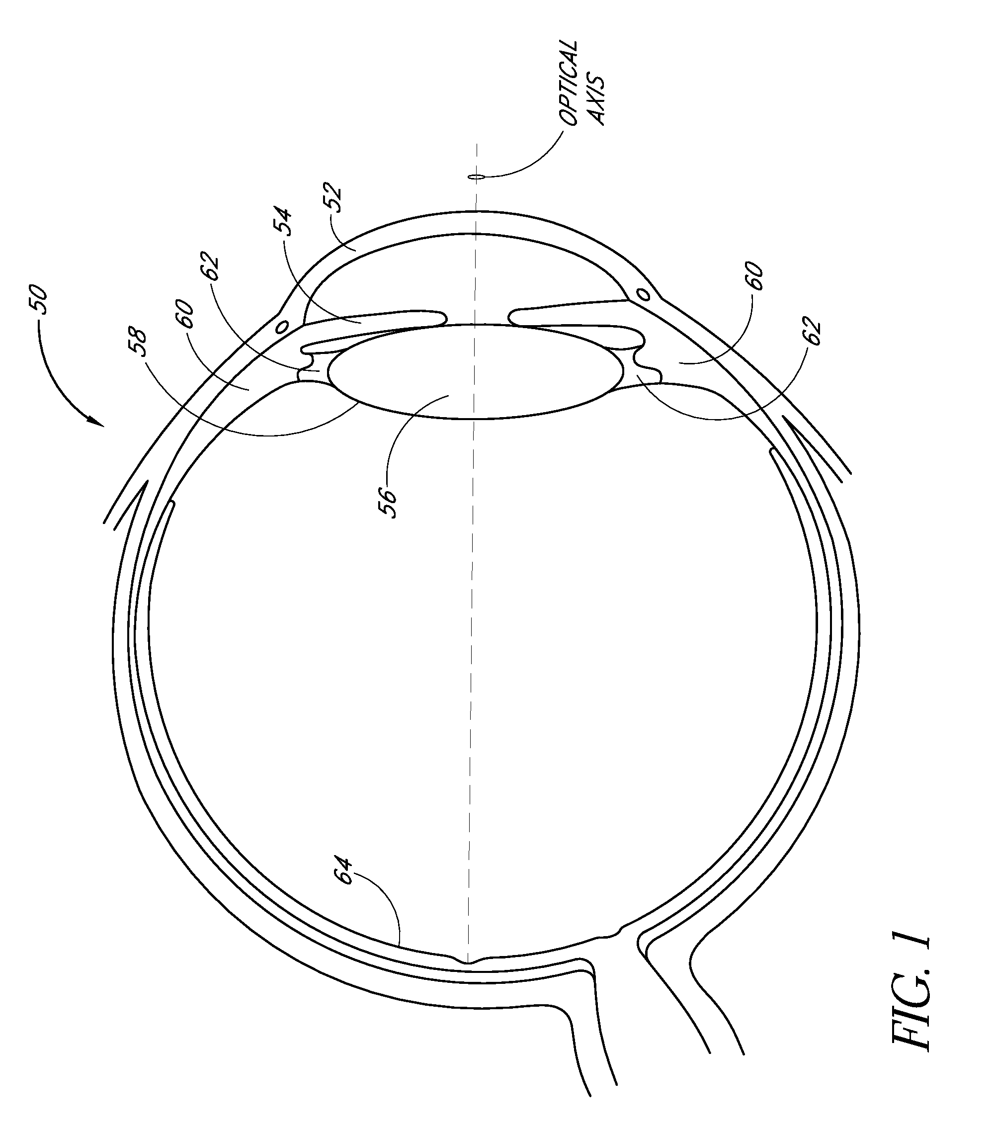 Intraocular lens with post-implantation adjustment capabilities