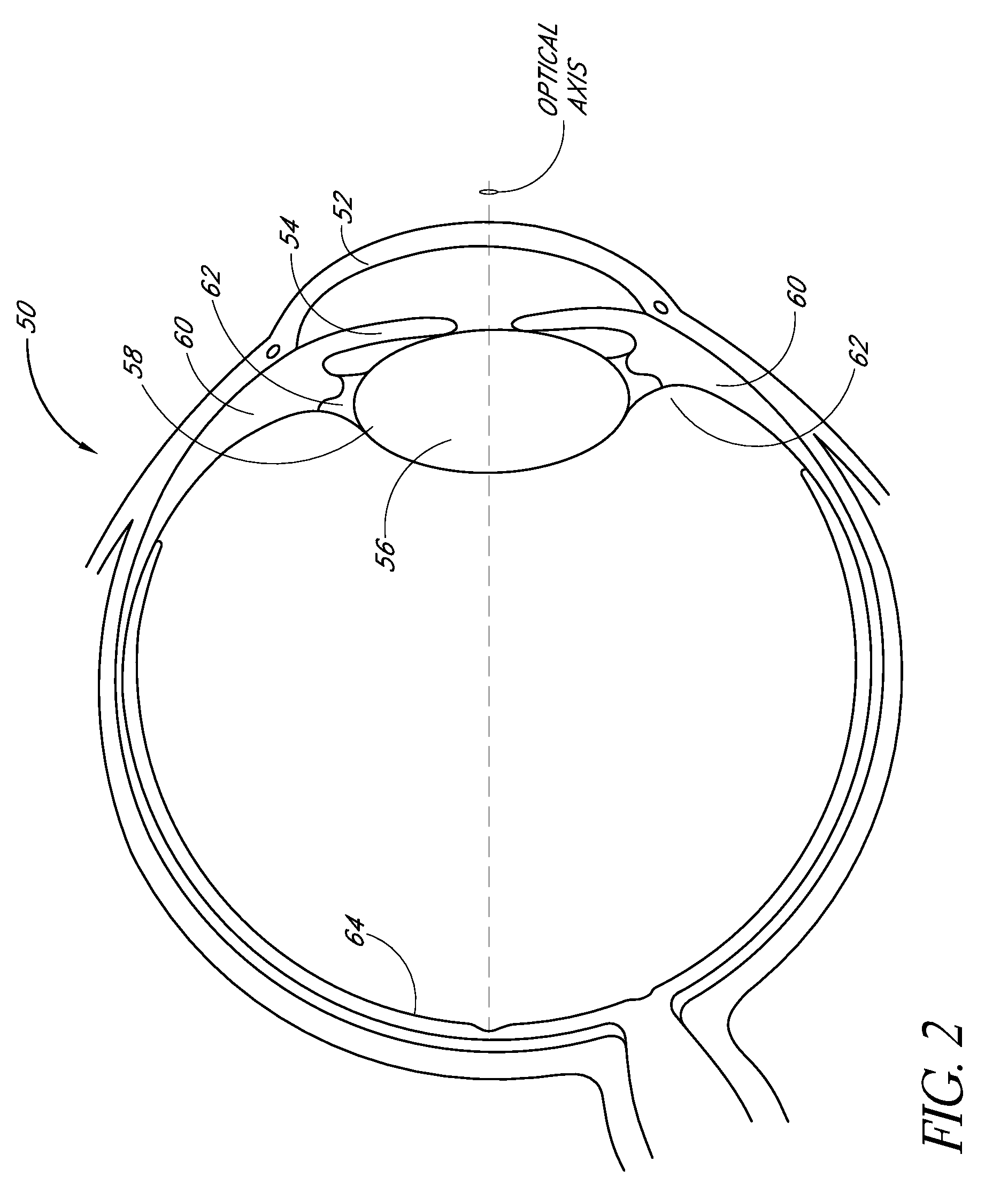 Intraocular lens with post-implantation adjustment capabilities
