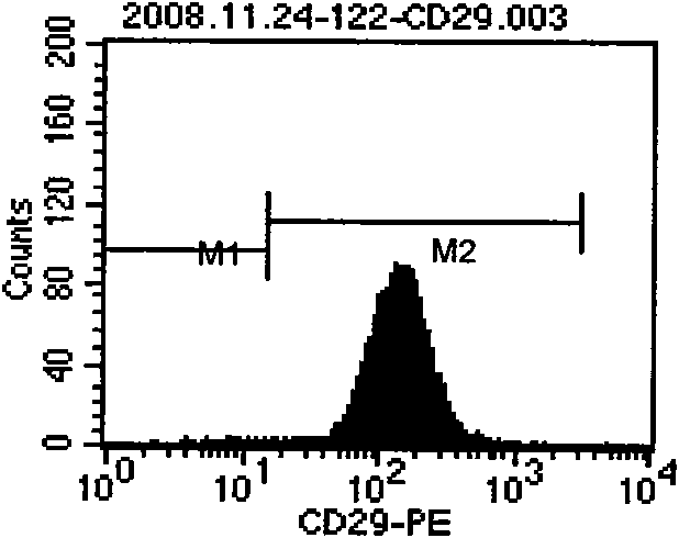 Method for obtaining mesenchyma stromal cells from connective tissue