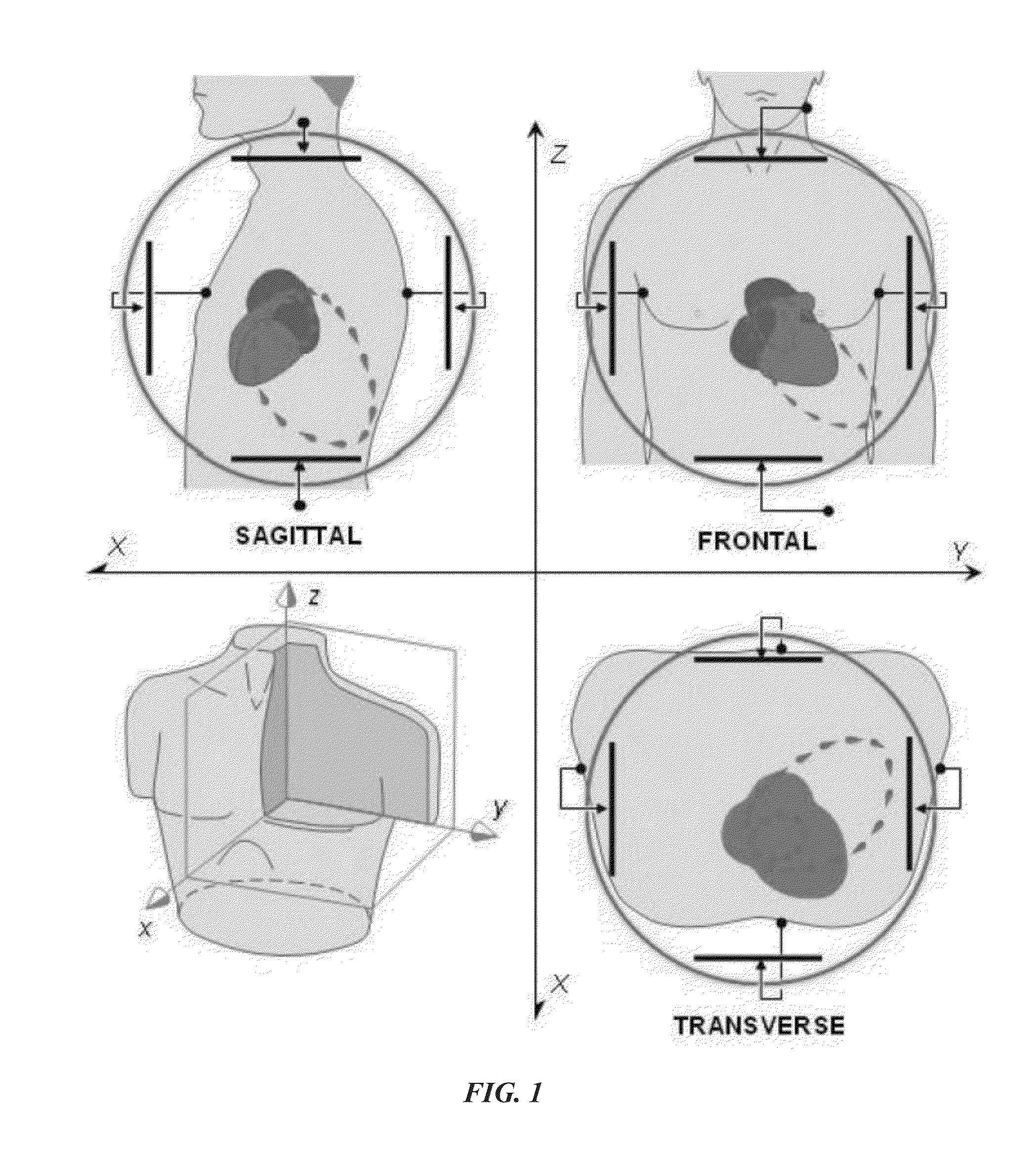 Integrated vectorcardiogram system and method of use