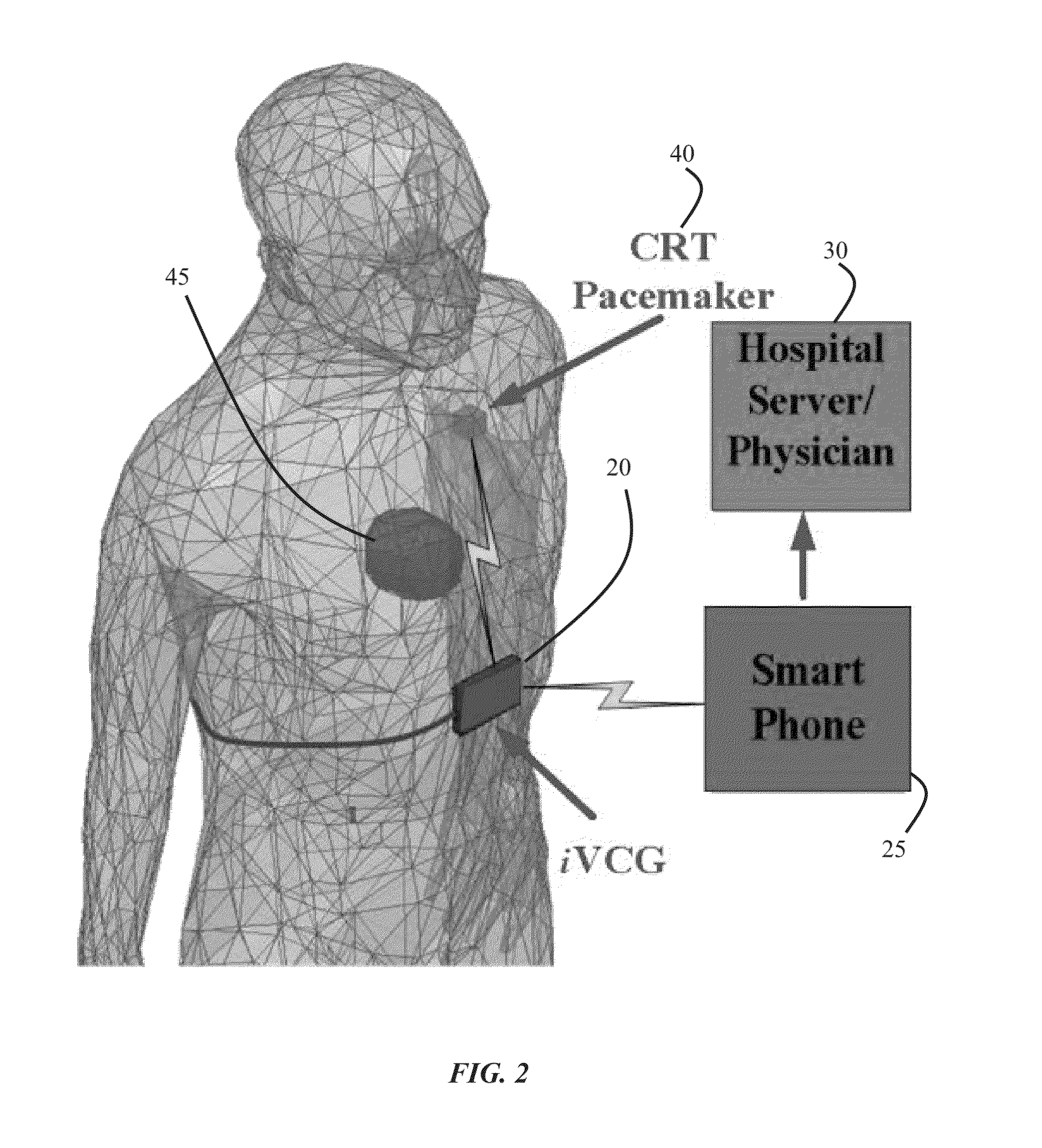 Integrated vectorcardiogram system and method of use