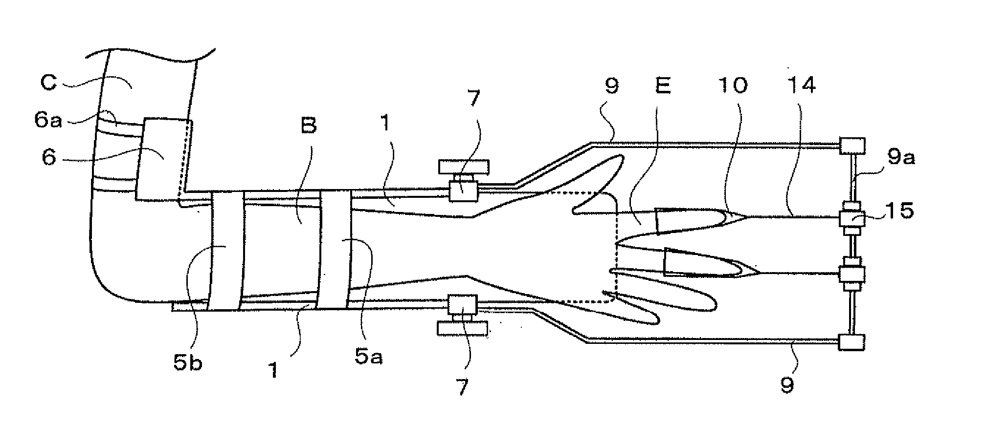 Portable or wearable fracture treatment device