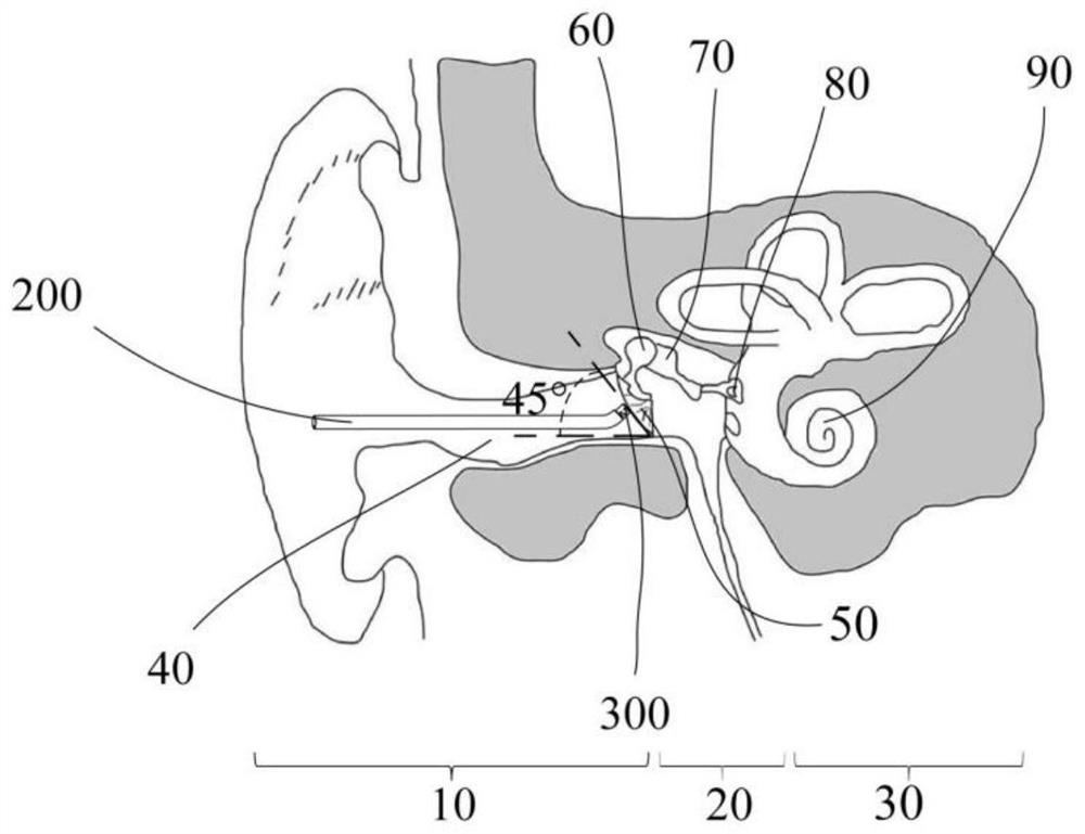 A preoperative evaluation tester for hearing compensation performance of artificial middle ear