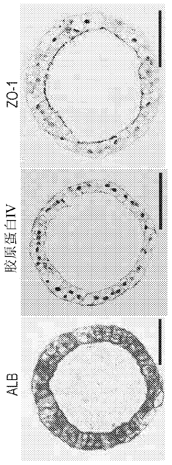 Liver organoid compositions and methods of making and using same