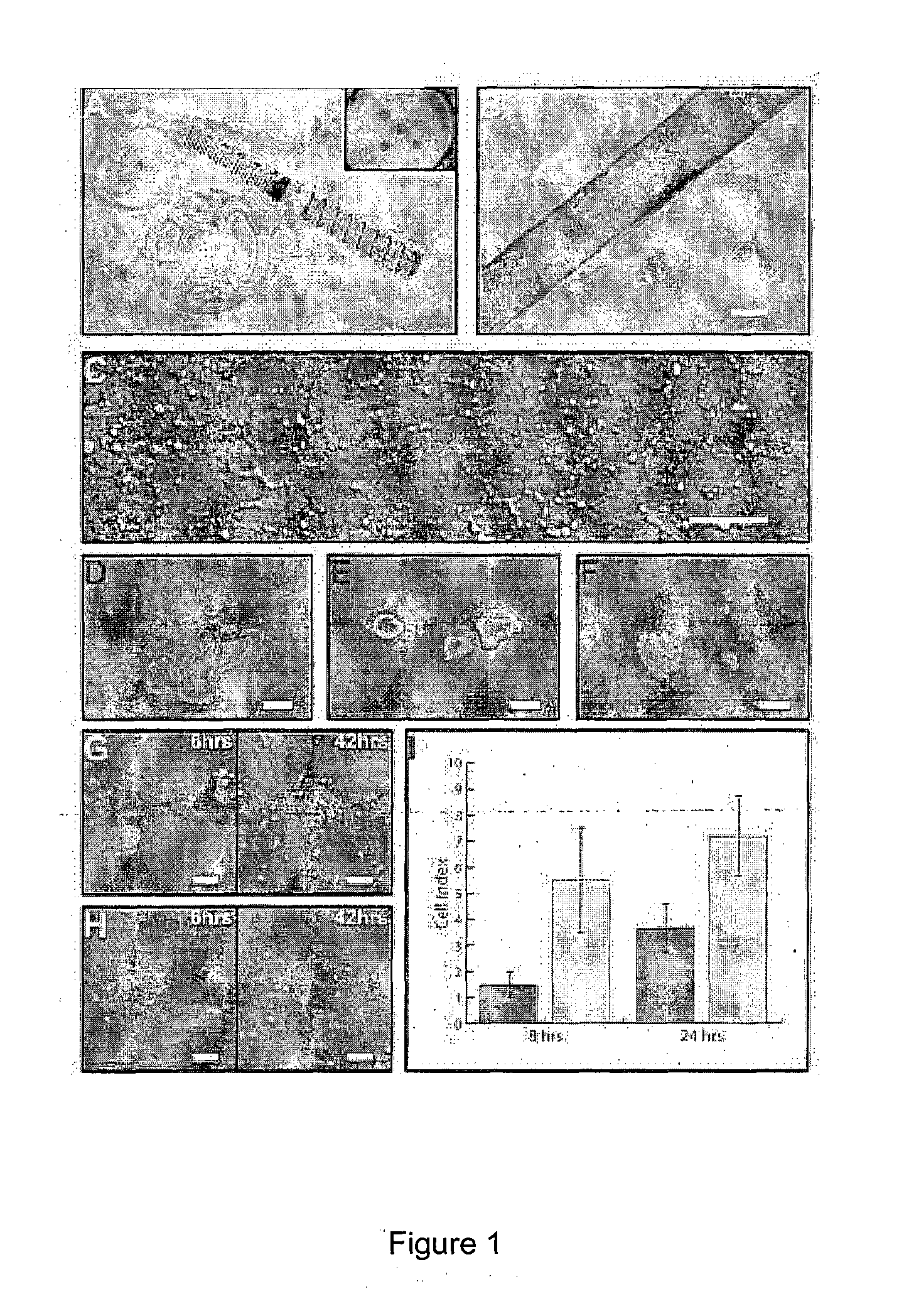 Cell culture of corneal endothelial cells