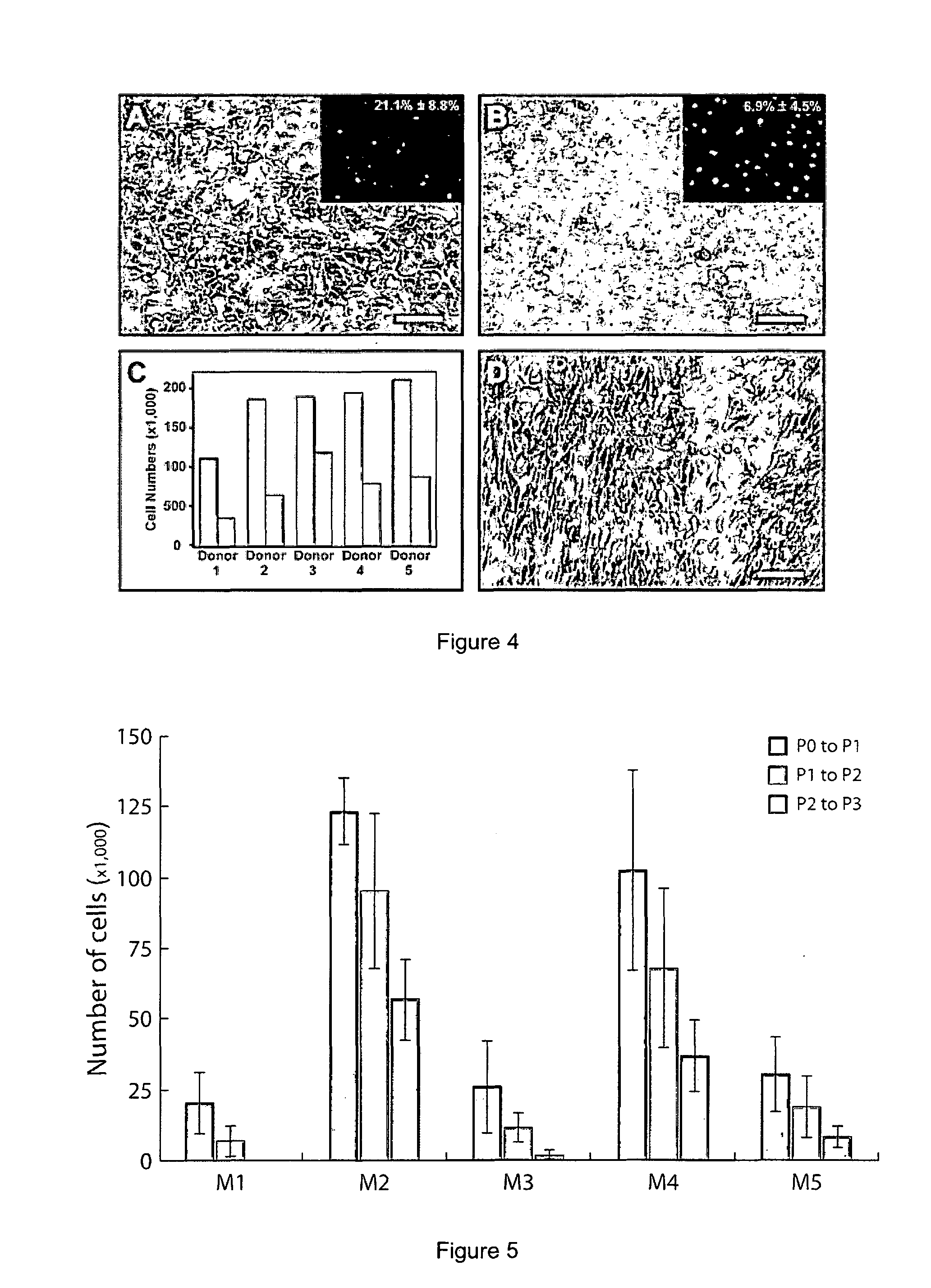 Cell culture of corneal endothelial cells