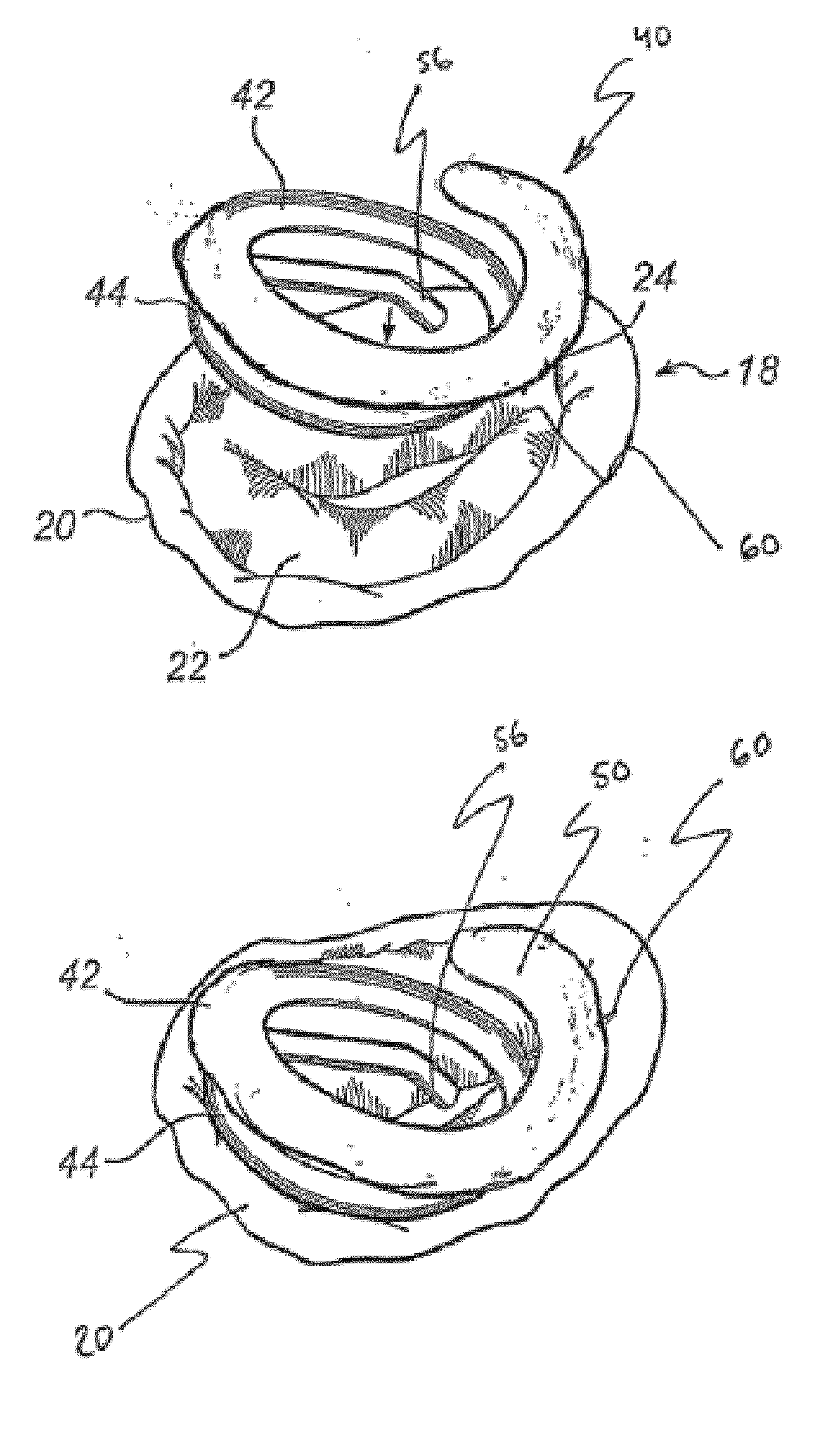 Device And Method For Improving Fixation Of A Medical Device