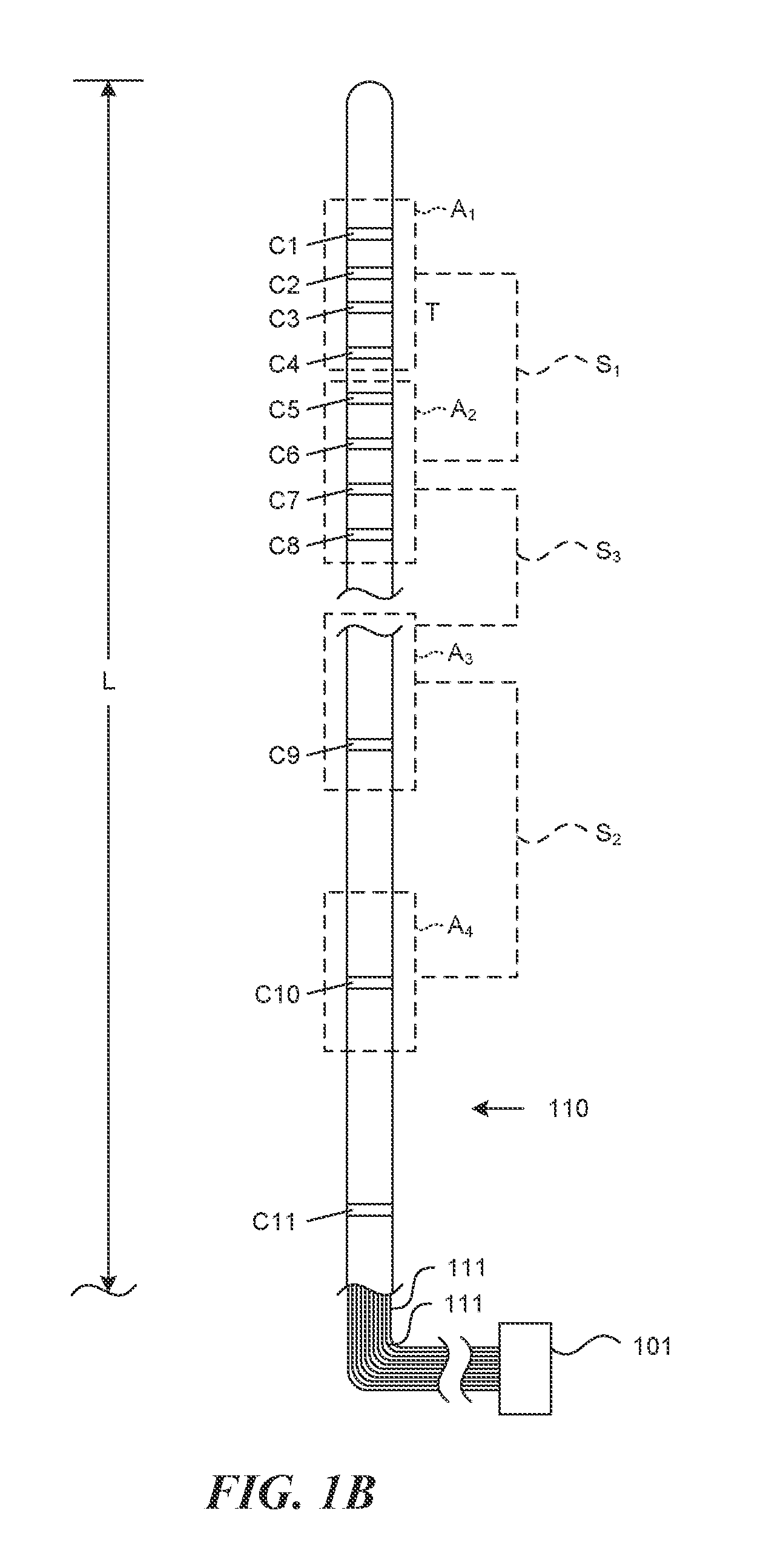 Linked area parameter adjustment for spinal cord stimulation and associated systems and methods