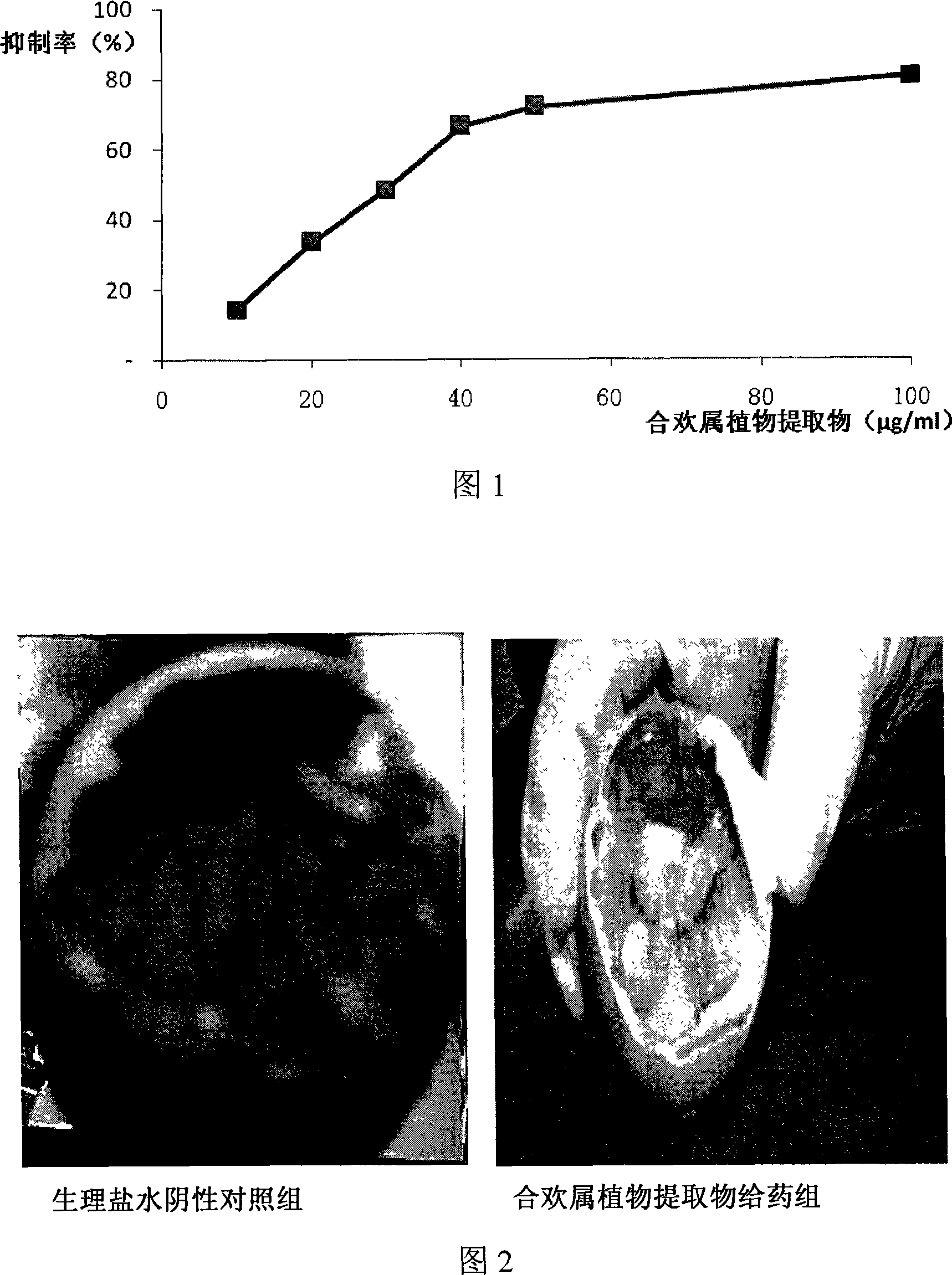 Albizzia plant extraction composition for inhibiting angiogenesis and preparation and application thereof