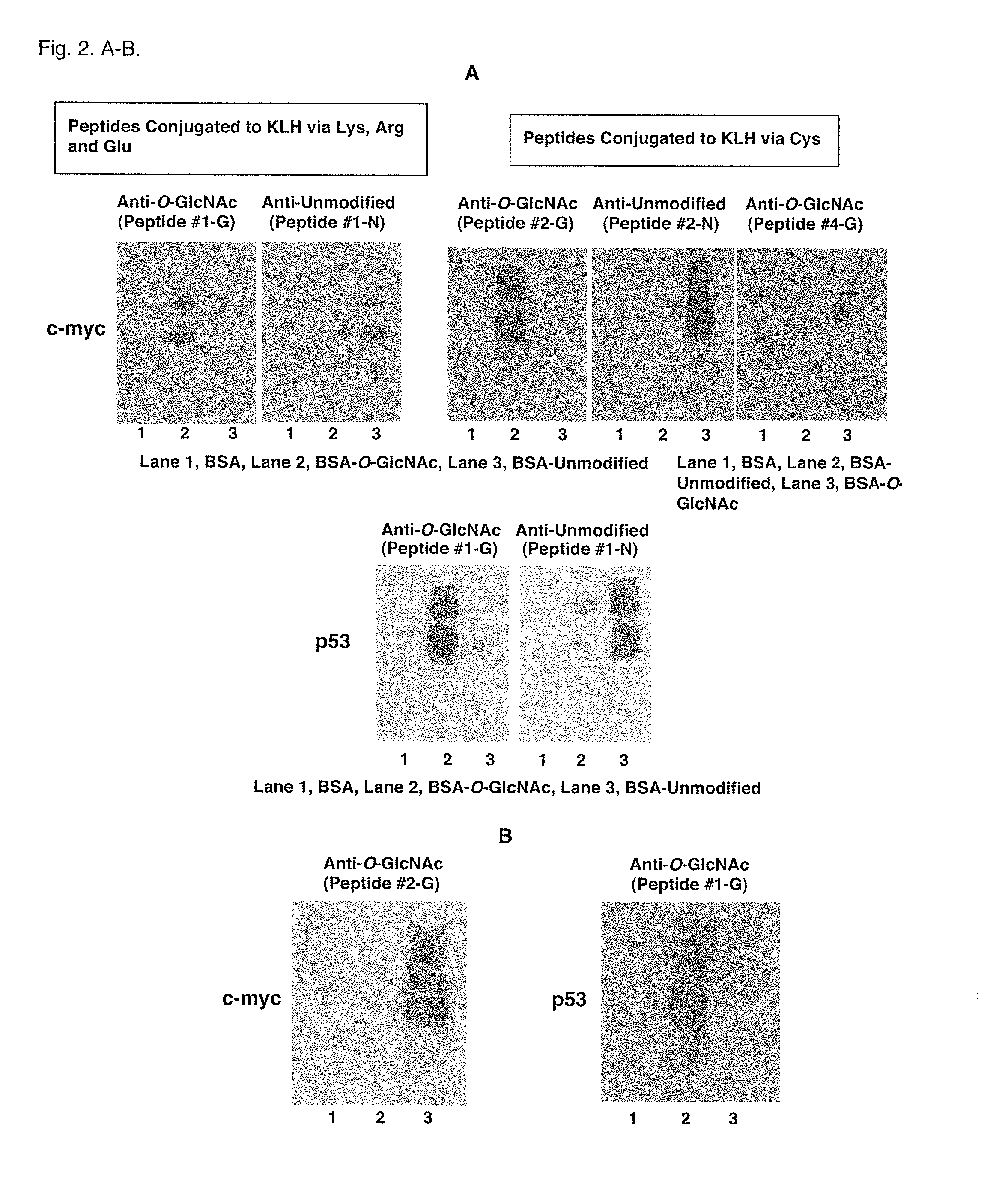 Glycosylation site-specific antibodies and Anti-cancer compounds