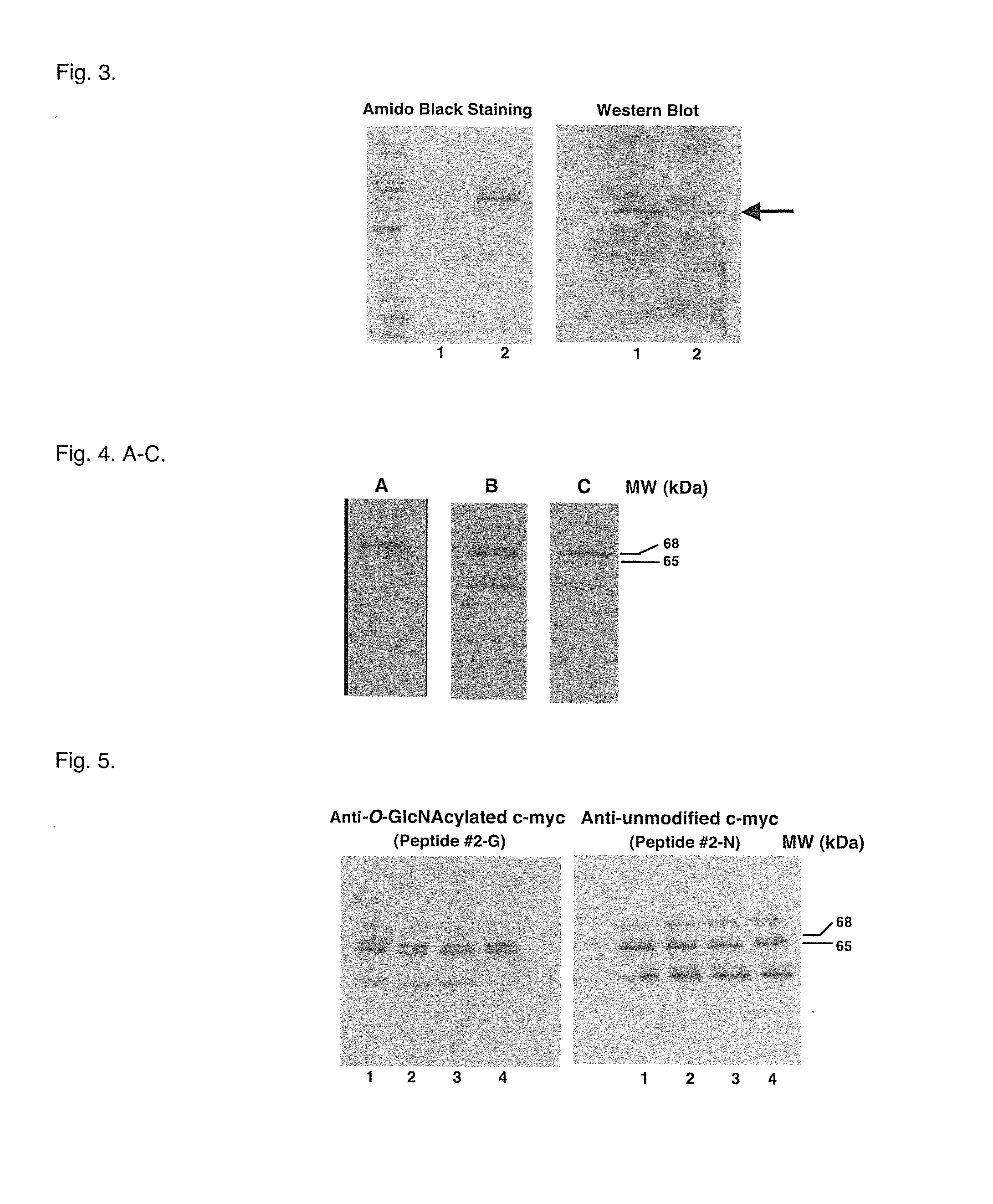 Glycosylation site-specific antibodies and Anti-cancer compounds