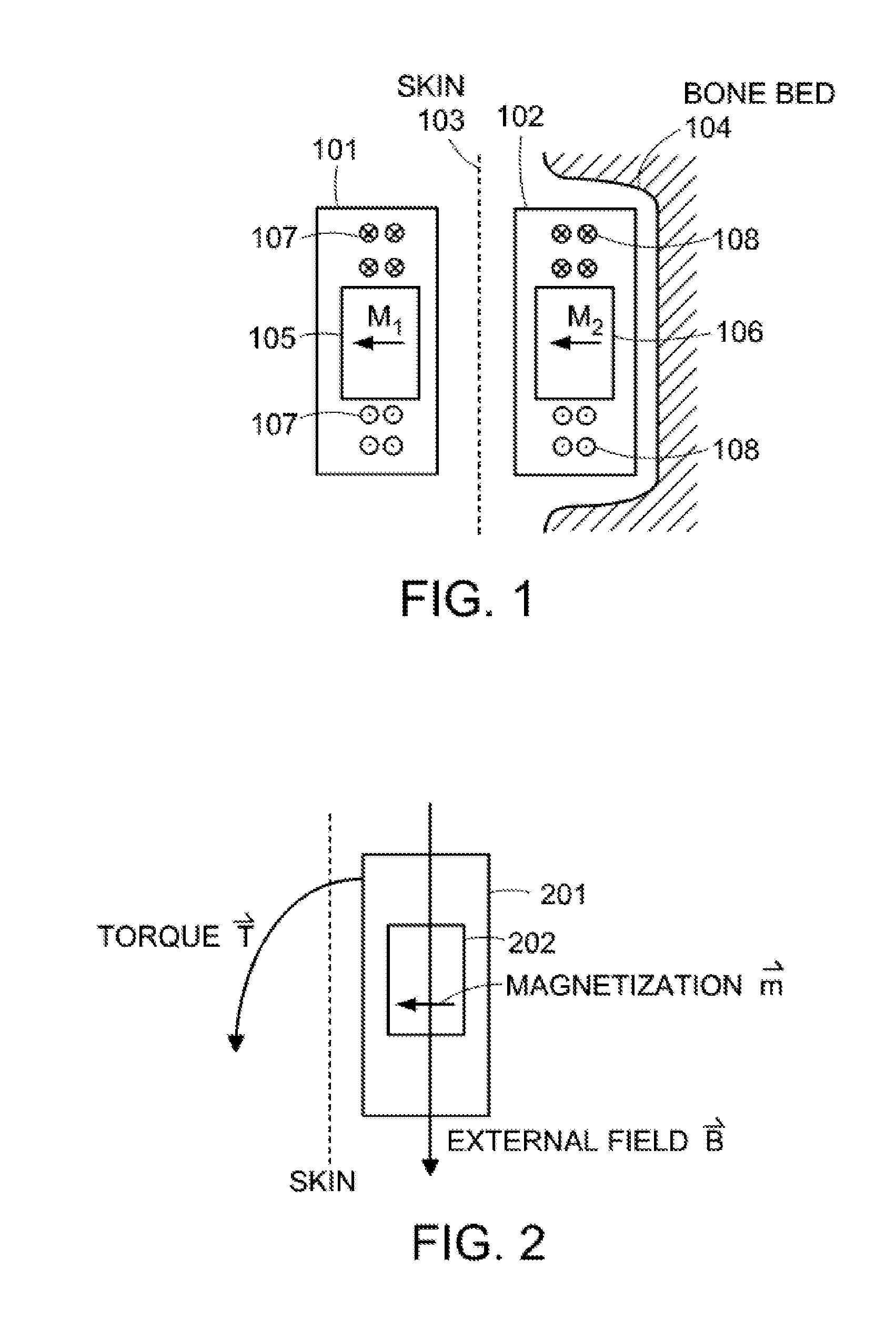 Magnetic Attachment System for Implantable Device