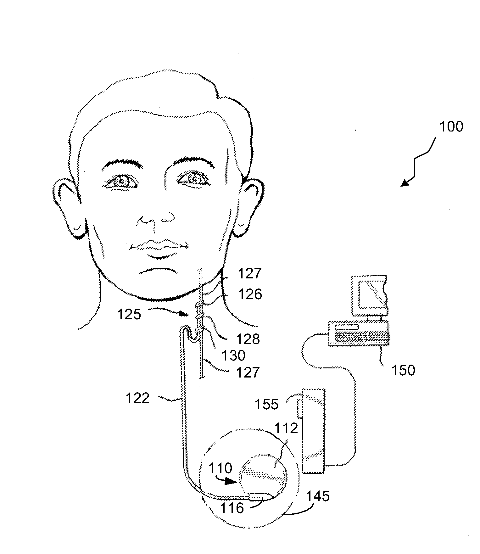 Dynamic lead condition detection for an implantable medical device