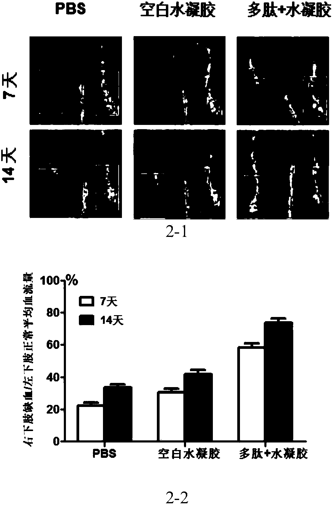Bioactive polypeptide and application thereof