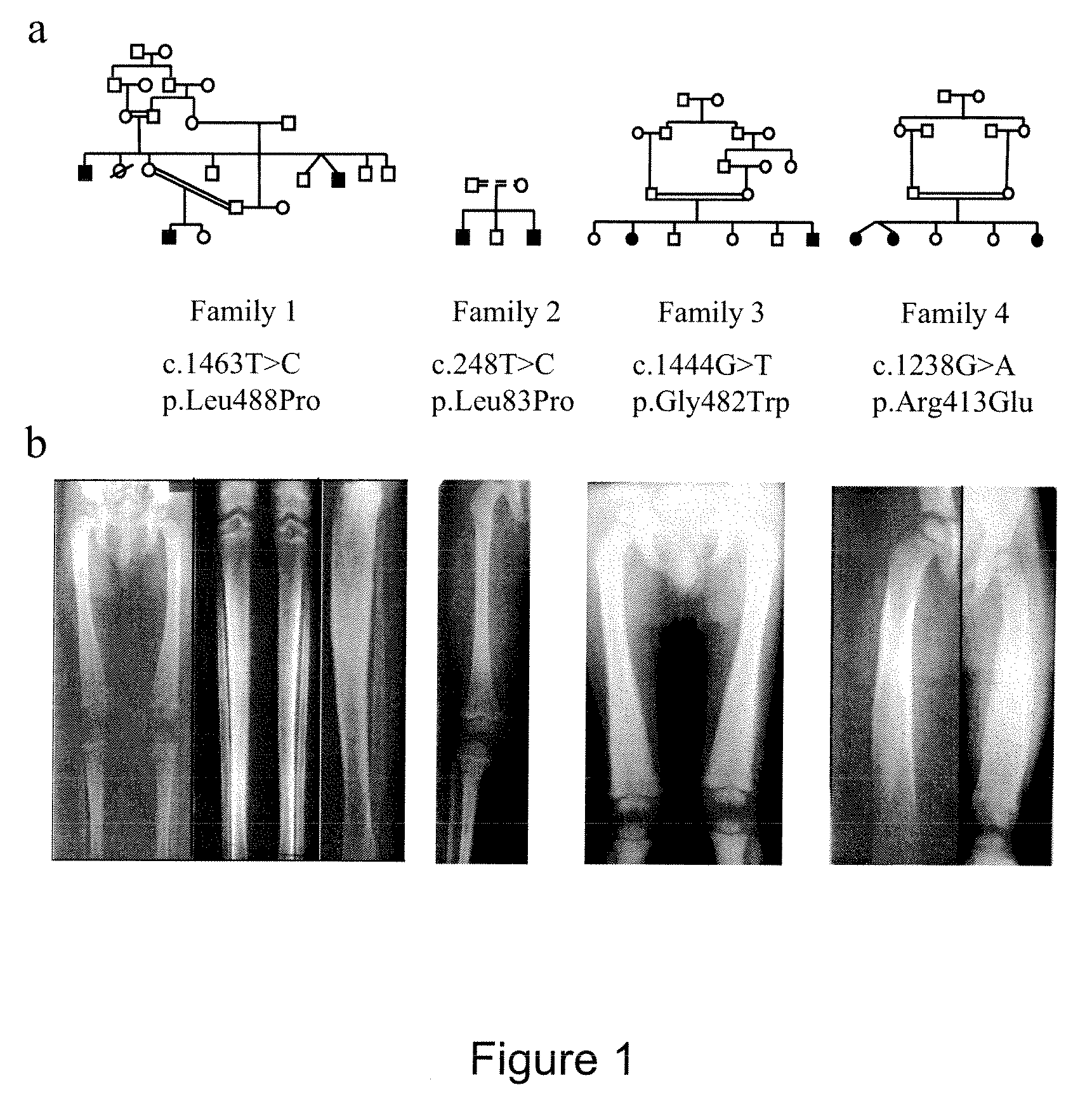 Methods for the Treatment and Diagnosis of Bone Mineral Density Related Diseases