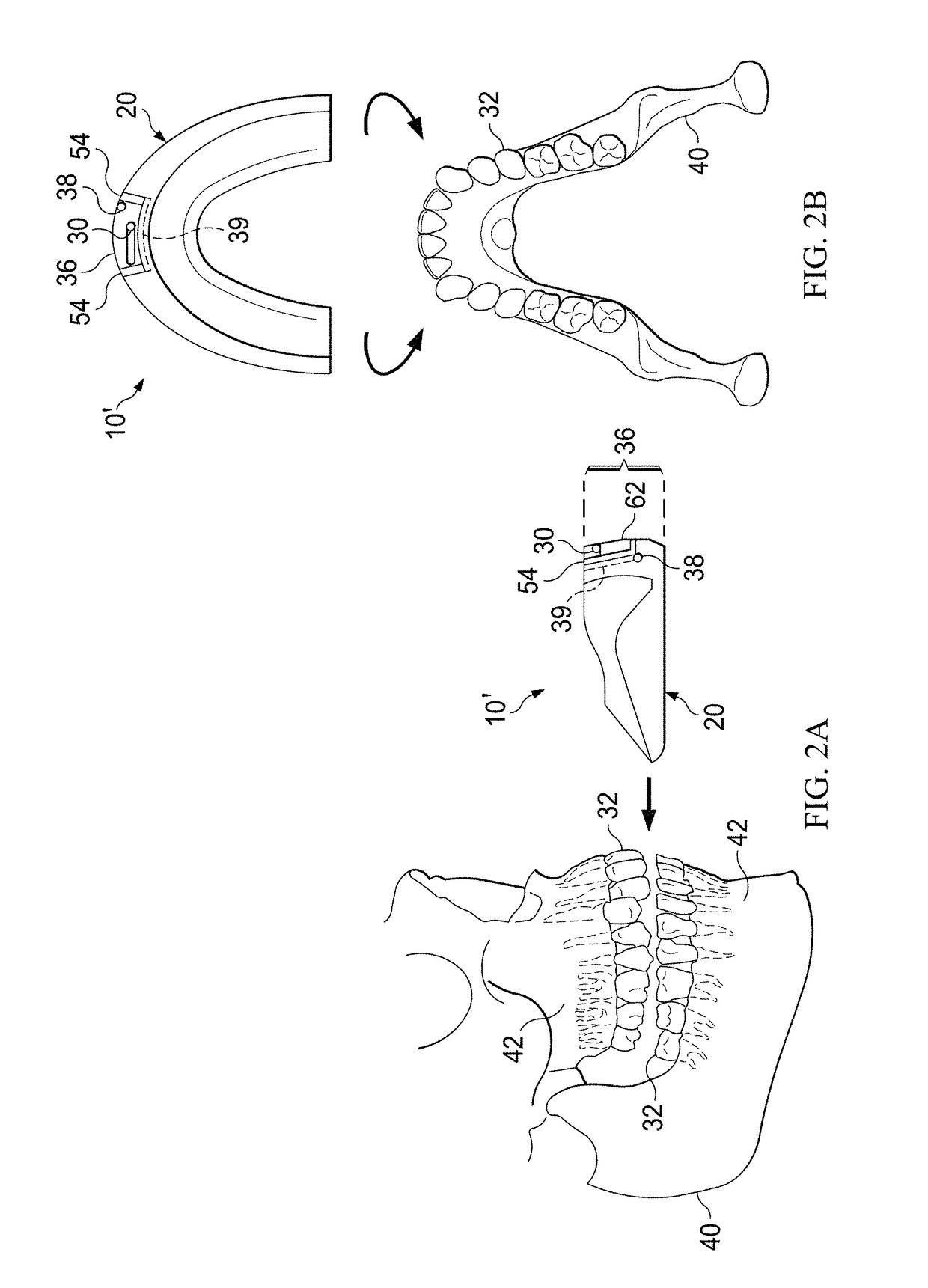 Pulsatile orthodontic device and methods